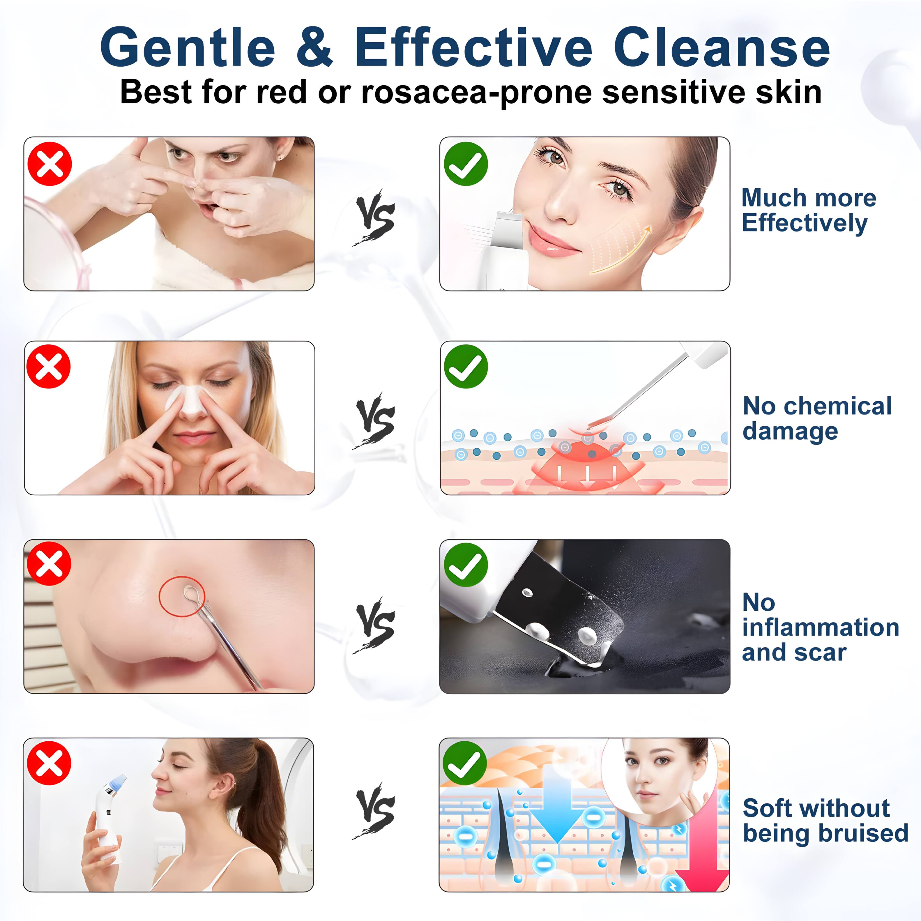 Gentle & Effective Cleanse  
Best for red or rosacea-prone sensitive skin  

- Much more Effectively  
- No chemical damage  
- No inflammation and scar  
- Soft without being bruised