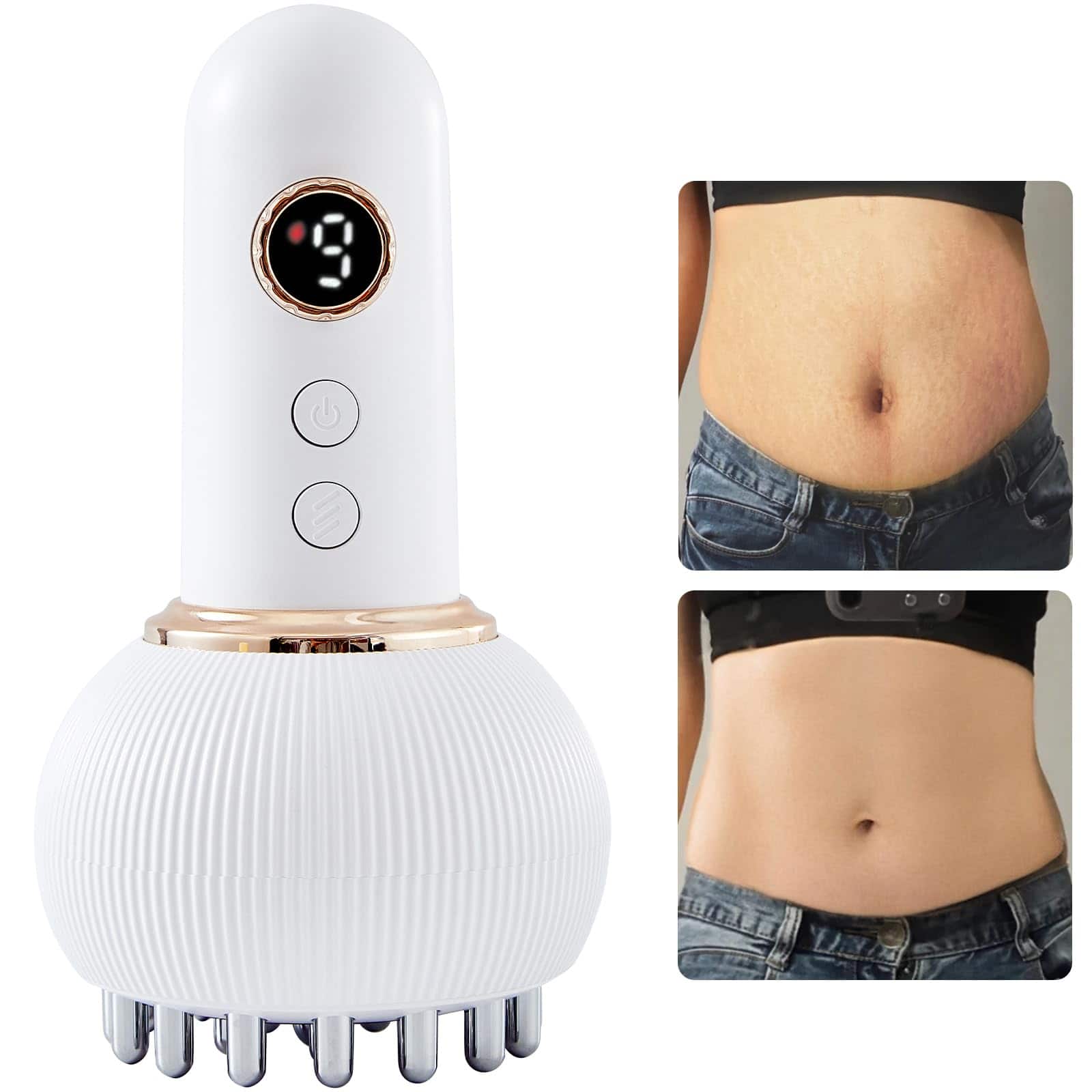 The Best Inks - Lymphatic Drainage & Anti Cellulite Massage Tool Helps Reduce Stretch Marks For Arms Belly Body Sculpting Machine With - Default