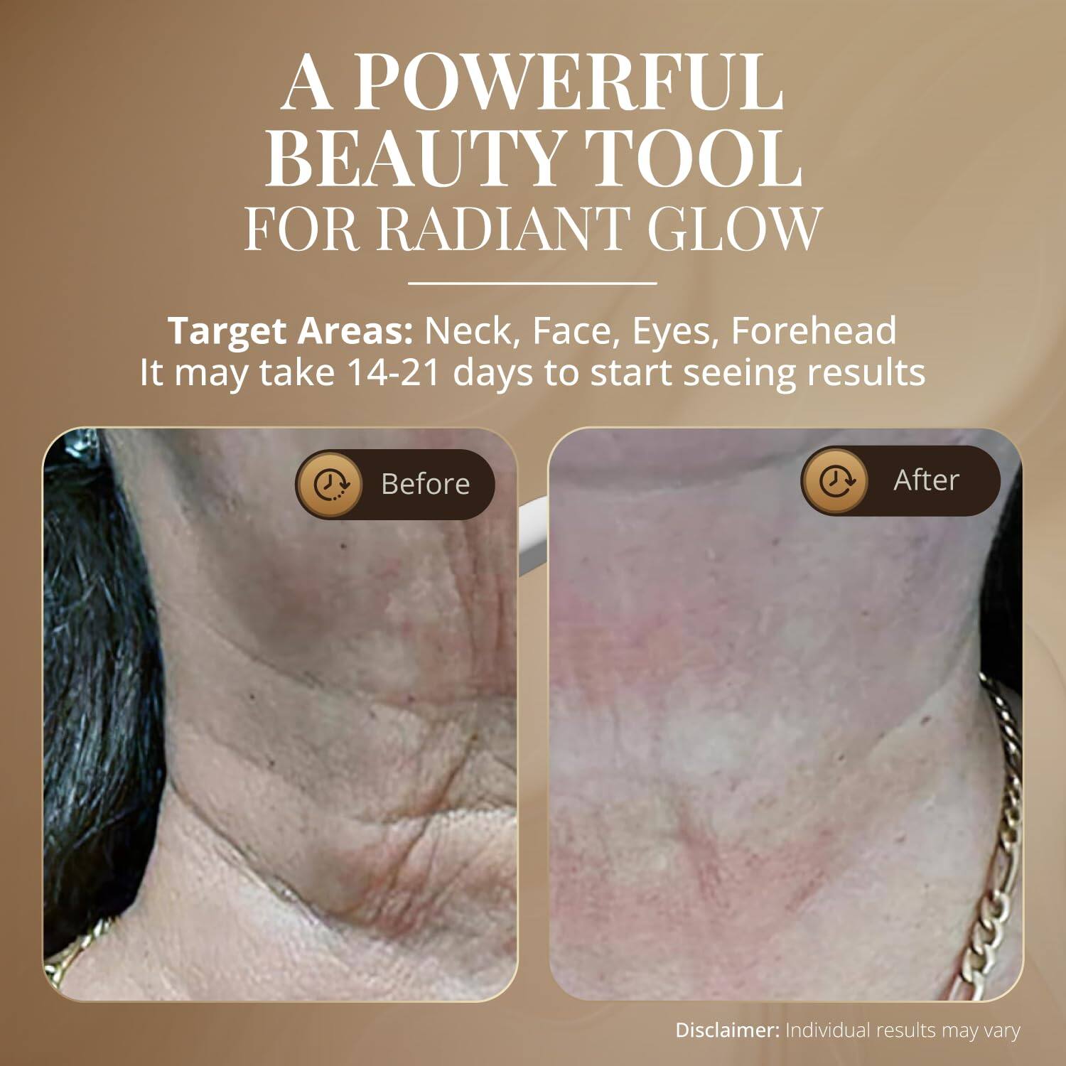 A POWERFUL BEAUTY TOOL FOR RADIANT GLOW

Target Areas: Neck, Face, Eyes, Forehead  
It may take 14-21 days to start seeing results

Before After

Disclaimer: Individual results may vary