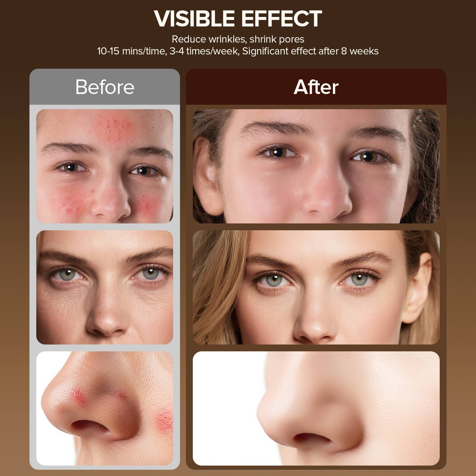 VISIBLE EFFECT  
Reduce wrinkles, shrink pores  
10-15 mins/time, 3-4 times/week, Significant effect after 8 weeks  

Before  
After