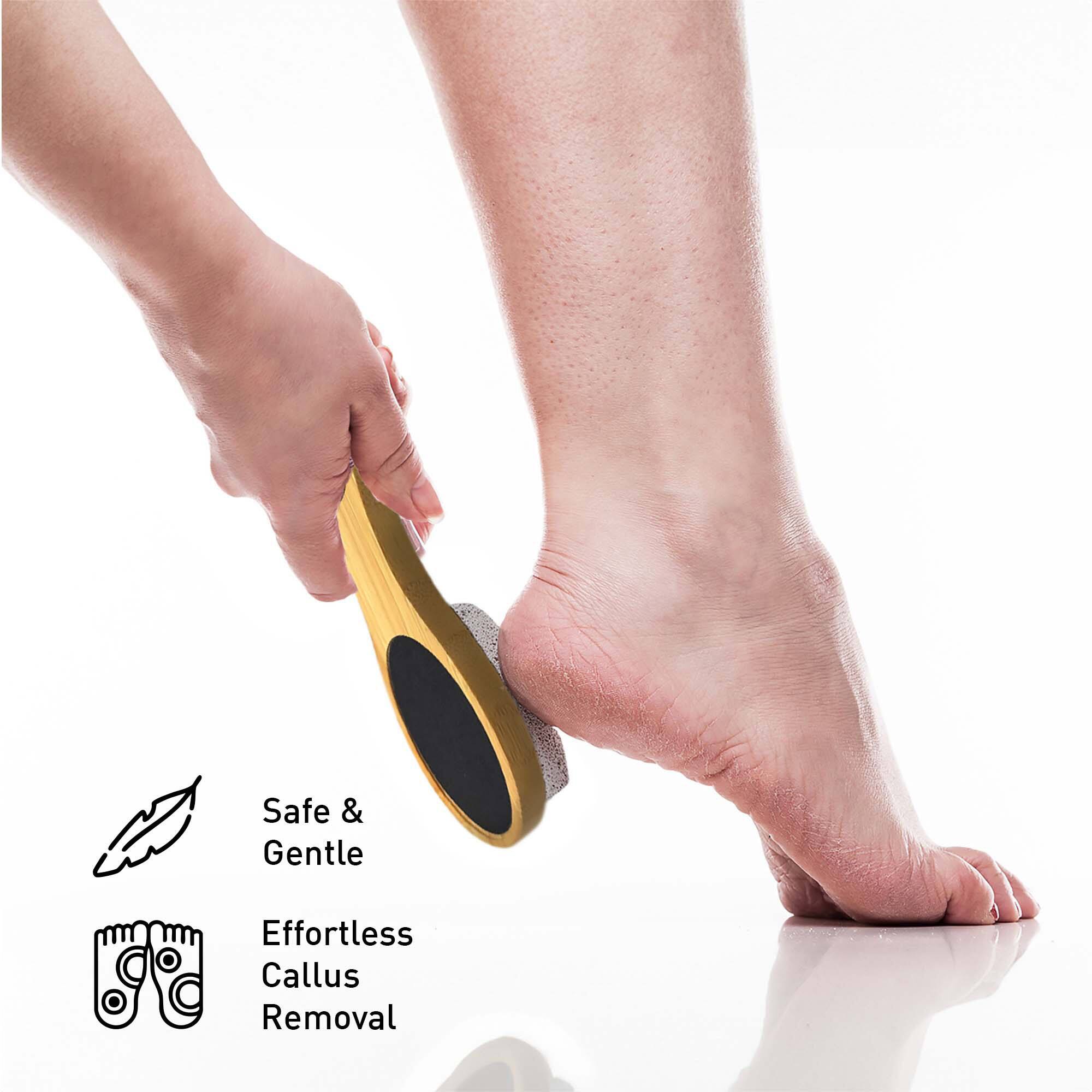 Safe & Gentle Effortless Callus Removal