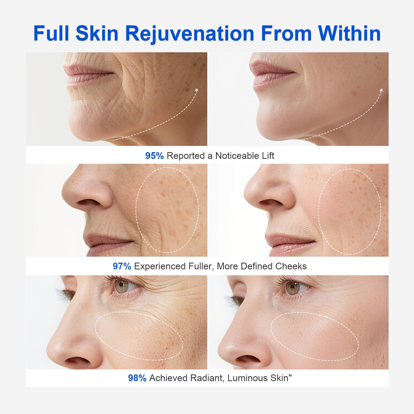 Full Skin Rejuvenation From Within

95% Reported a Noticeable Lift

97% Experienced Fuller, More Defined Cheeks

98% Achieved Radiant, Luminous Skin