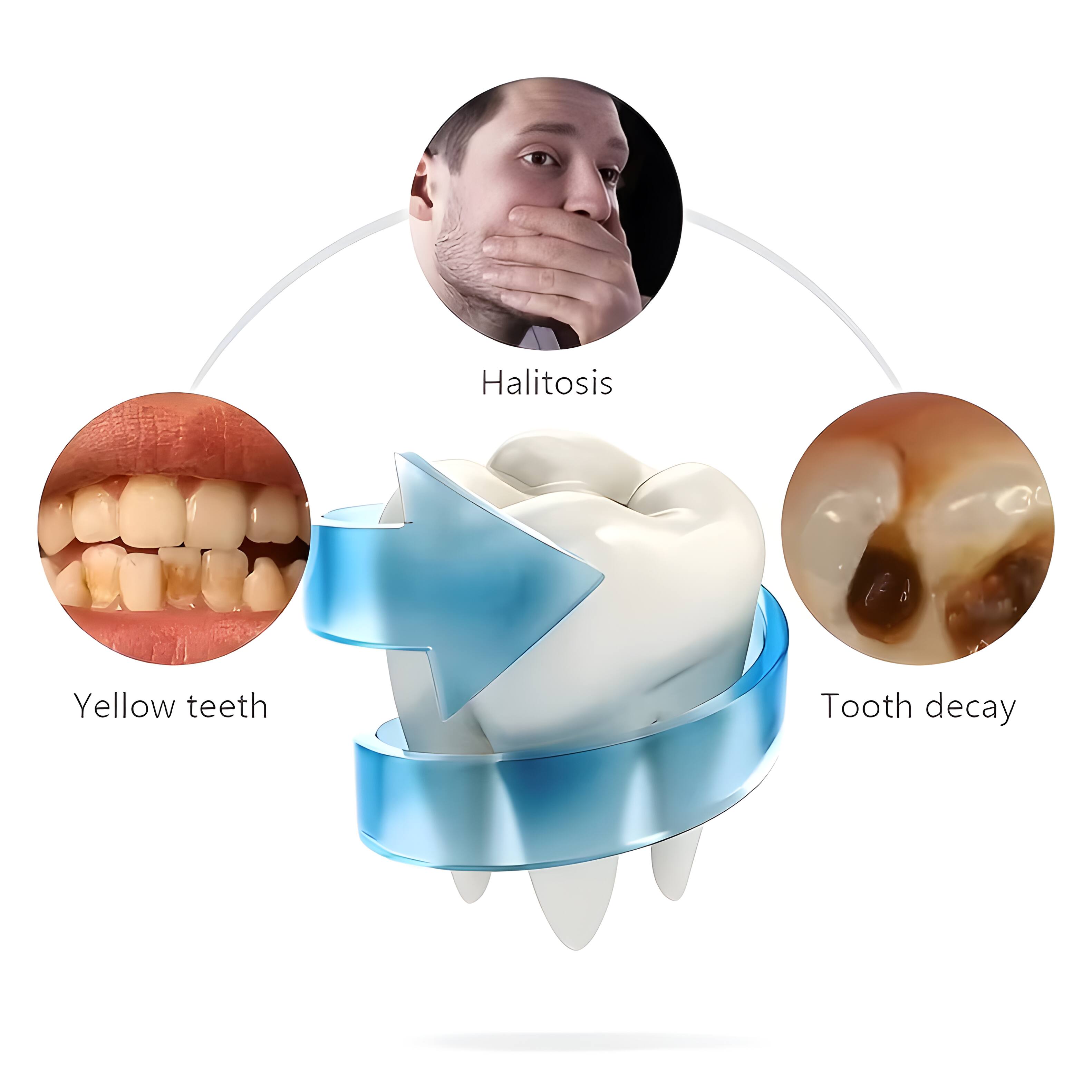 Halitosis  
Yellow teeth  
Tooth decay