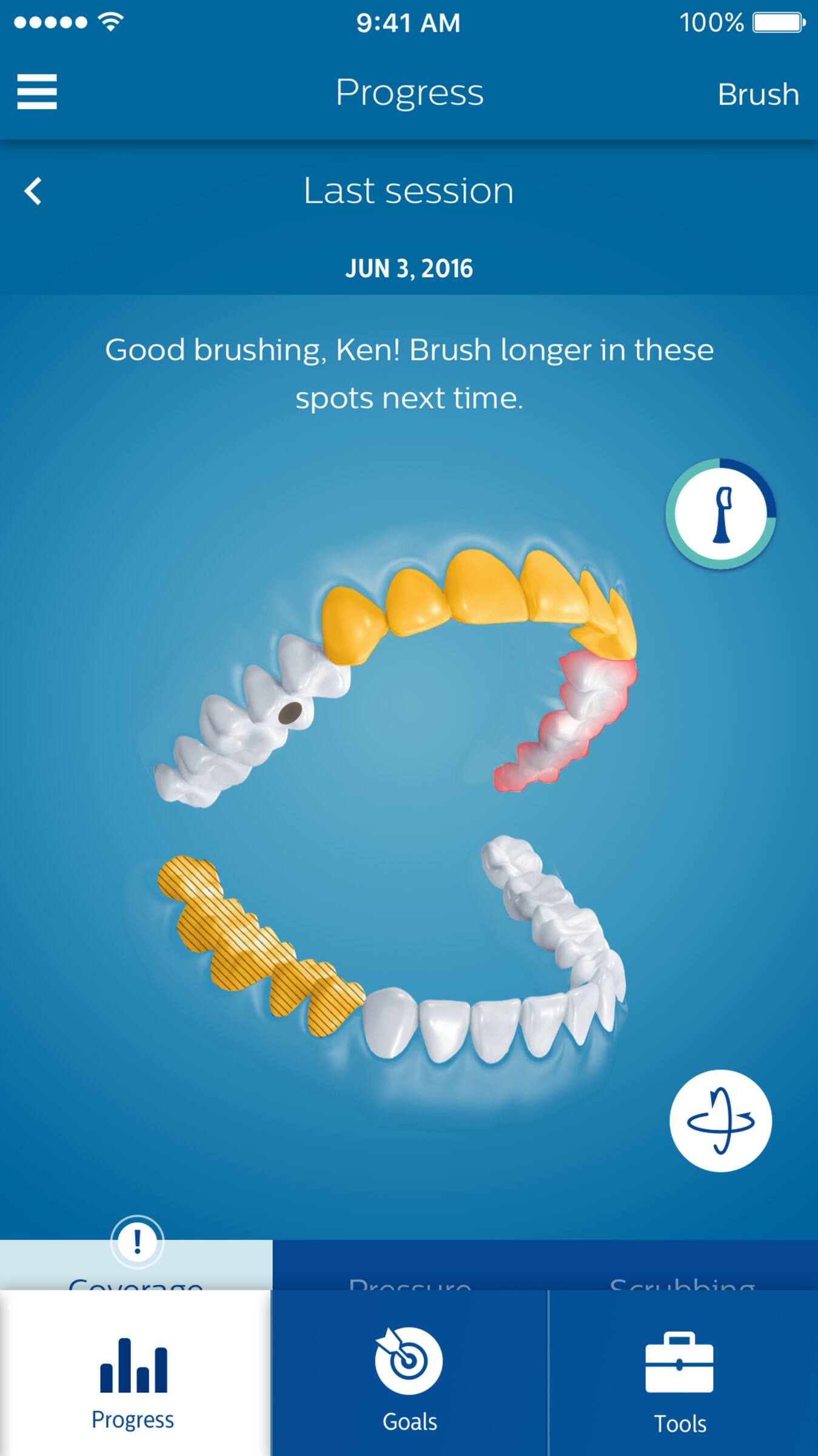 9:41 AM  
100%  

Progress  
Brush  

Last session  
JUN 3, 2016  

Good brushing, Ken! Brush longer in these spots next time.  

Progress  
Goals  
Tools  

Coverage  
Progress  
Goals  
Tools
