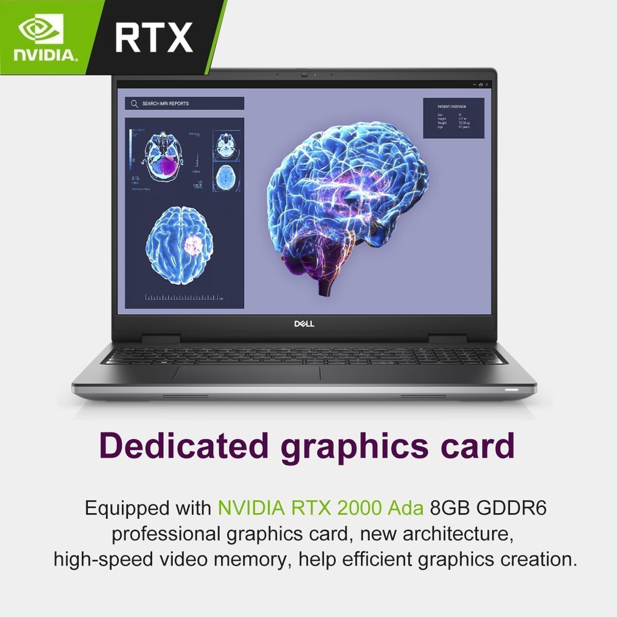 RTX NVIDIA. SEARCH - REPORTS

Dedicated graphics card

Equipped with NVIDIA RTX 2000 Ada 8GB GDDR6 professional graphics card, new architecture, high-speed video memory, help efficient graphics creation.
