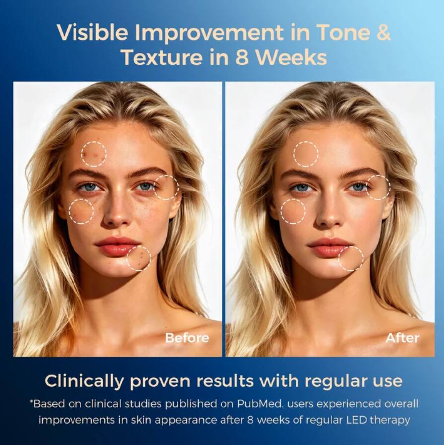 Visible Improvement in Tone & Texture in 8 Weeks

Before After

Clinically proven results with regular use
*Based on clinical studies published on PubMed. users experienced overall improvements in skin appearance after 8 weeks of regular LED therapy