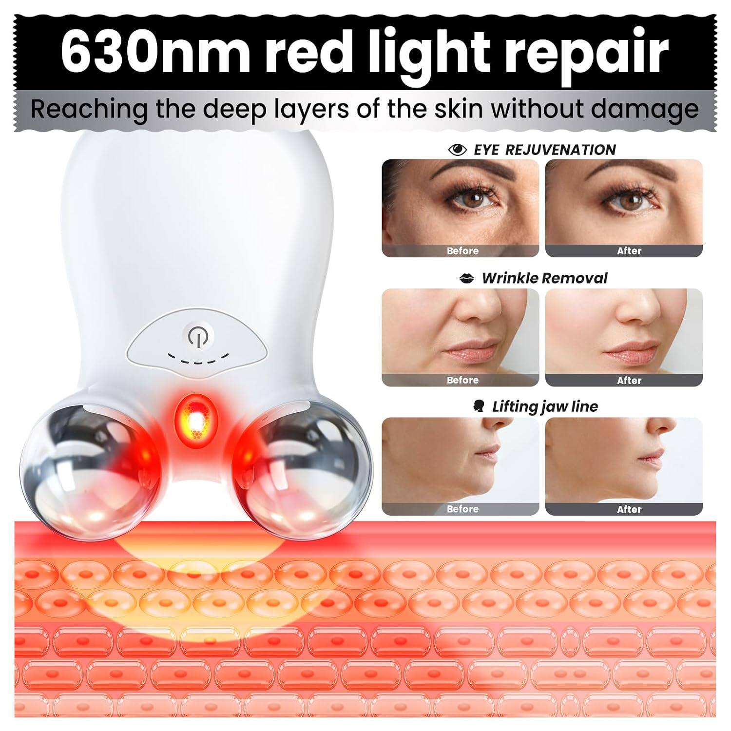 630nm red light repair  
Reaching the deep layers of the skin without damage  

EYE REJUVENATION  
Before After  

Wrinkle Removal  
Before After  

Lifting jaw line  
Before After
