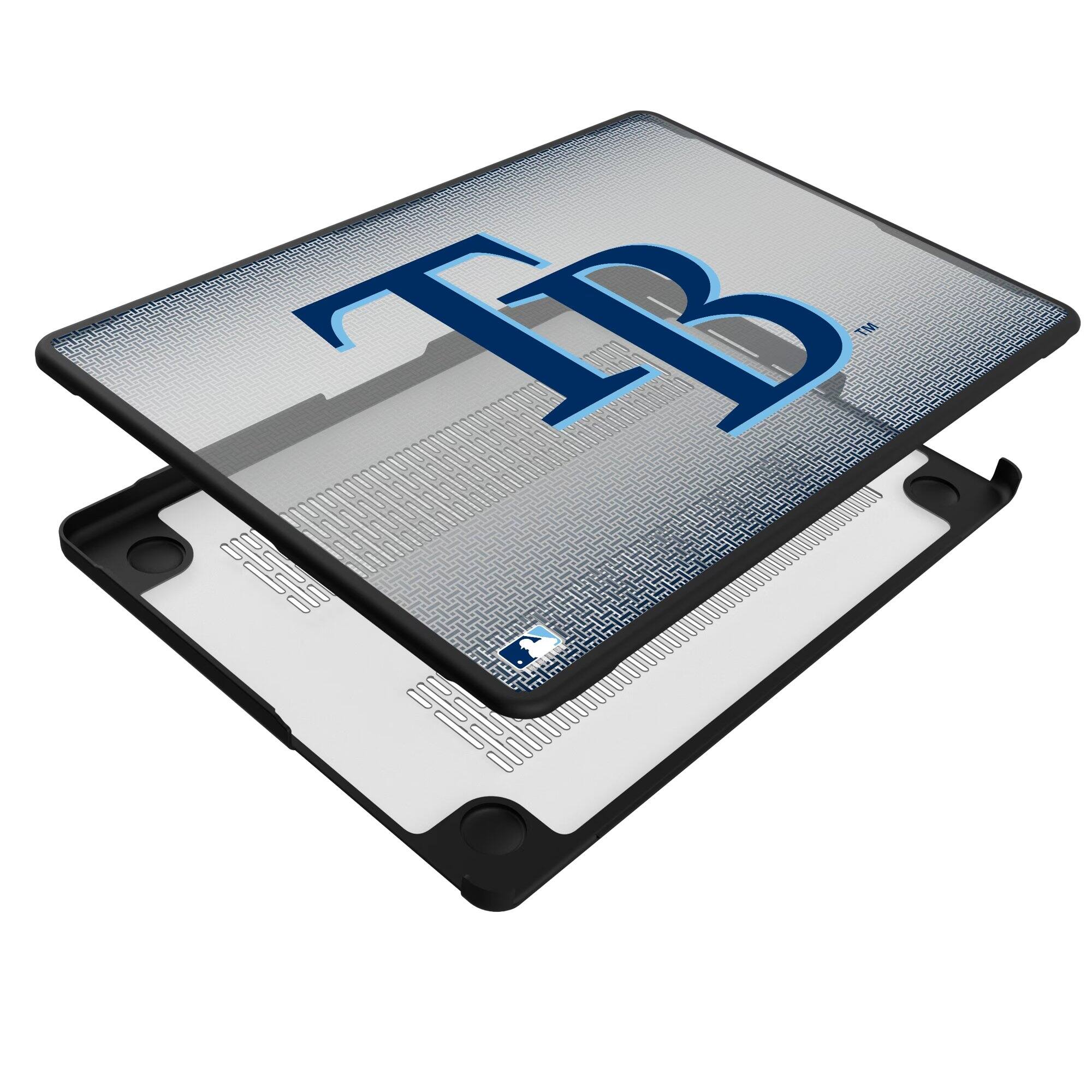 The text on the image is:

"TB"