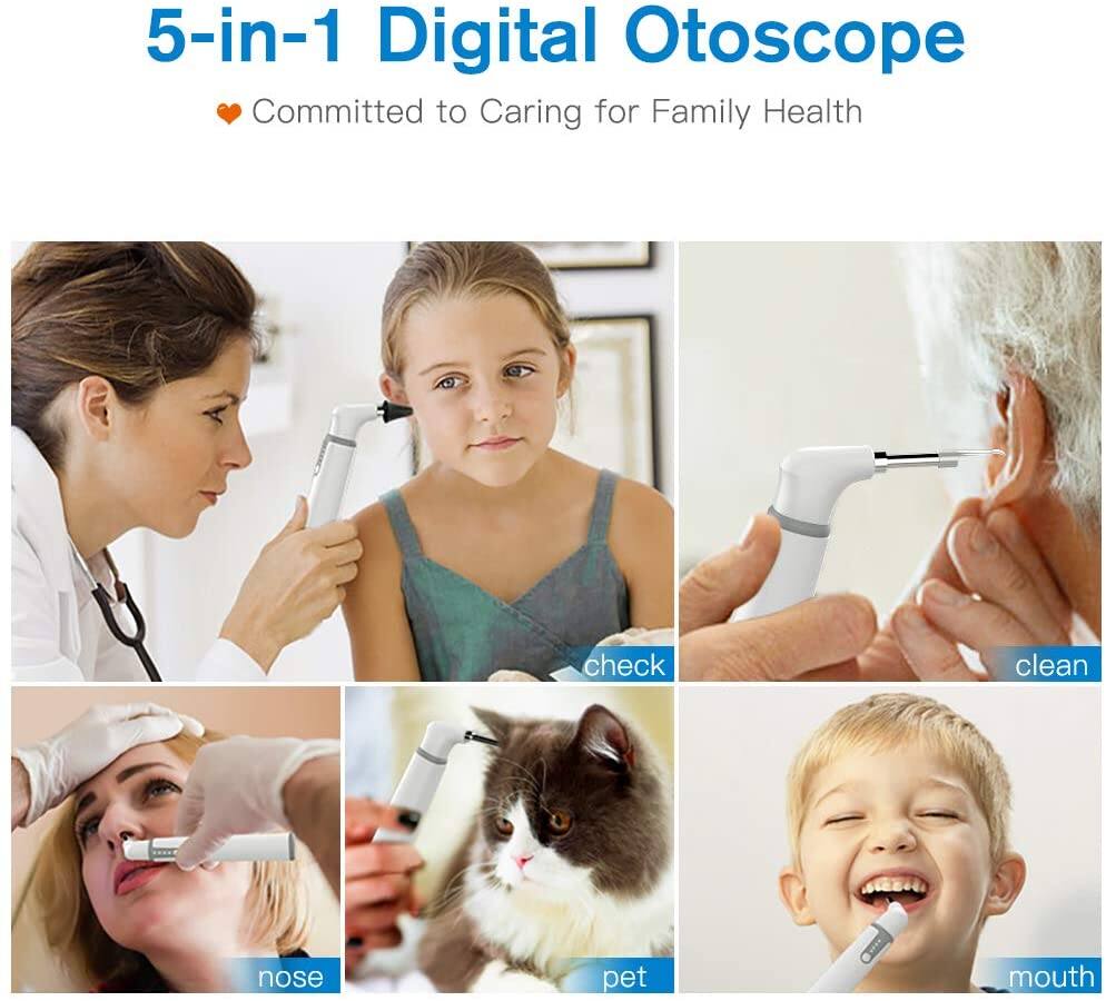 Scopearound SA39W Multipurpose Wireless Smart Otoscope & Ear Cleaning ...
