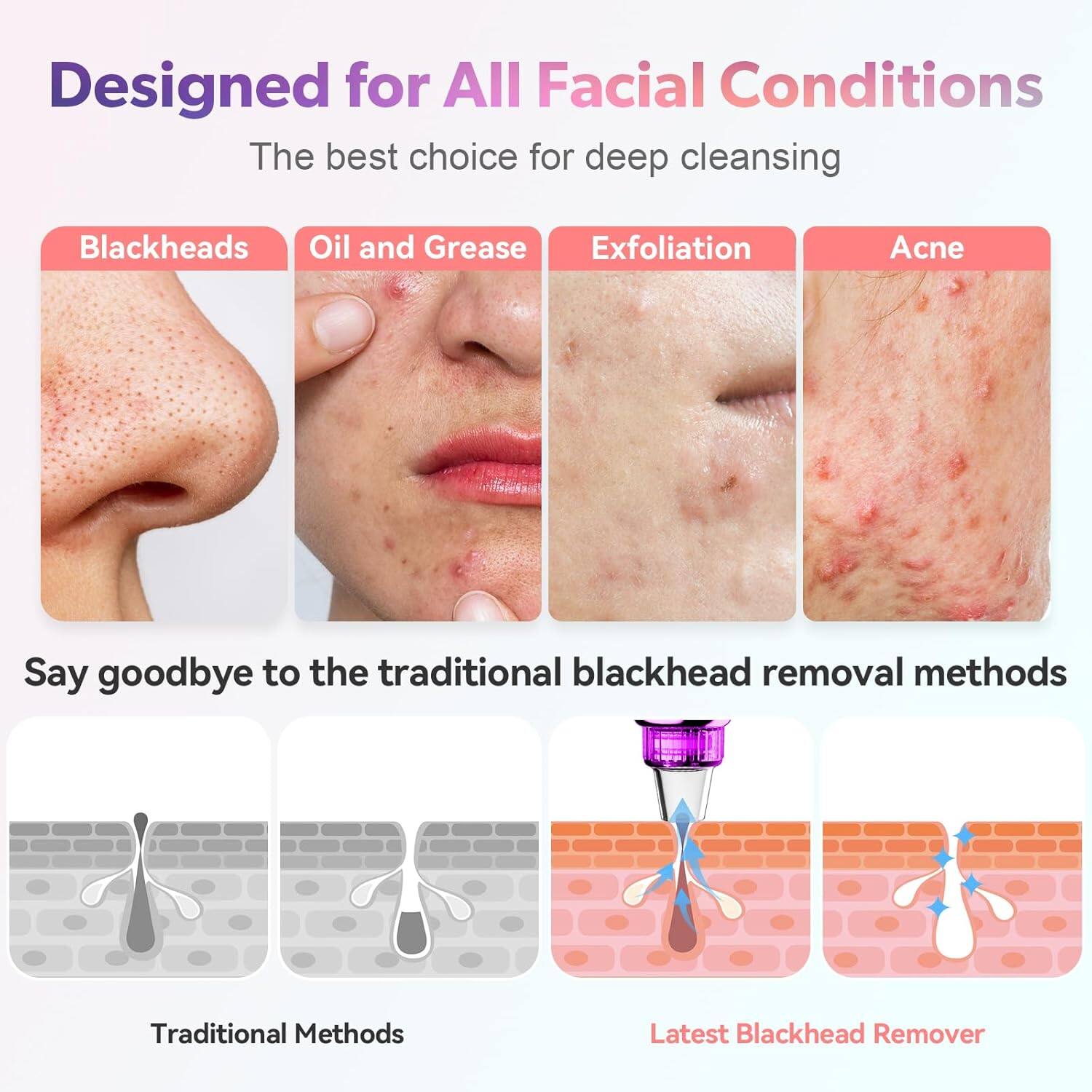 Designed for All Facial Conditions  
The best choice for deep cleansing  

Blackheads  
Oil and Grease  
Exfoliation  
Acne  

Say goodbye to the traditional blackhead removal methods  

Traditional Methods  
Latest Blackhead Remover