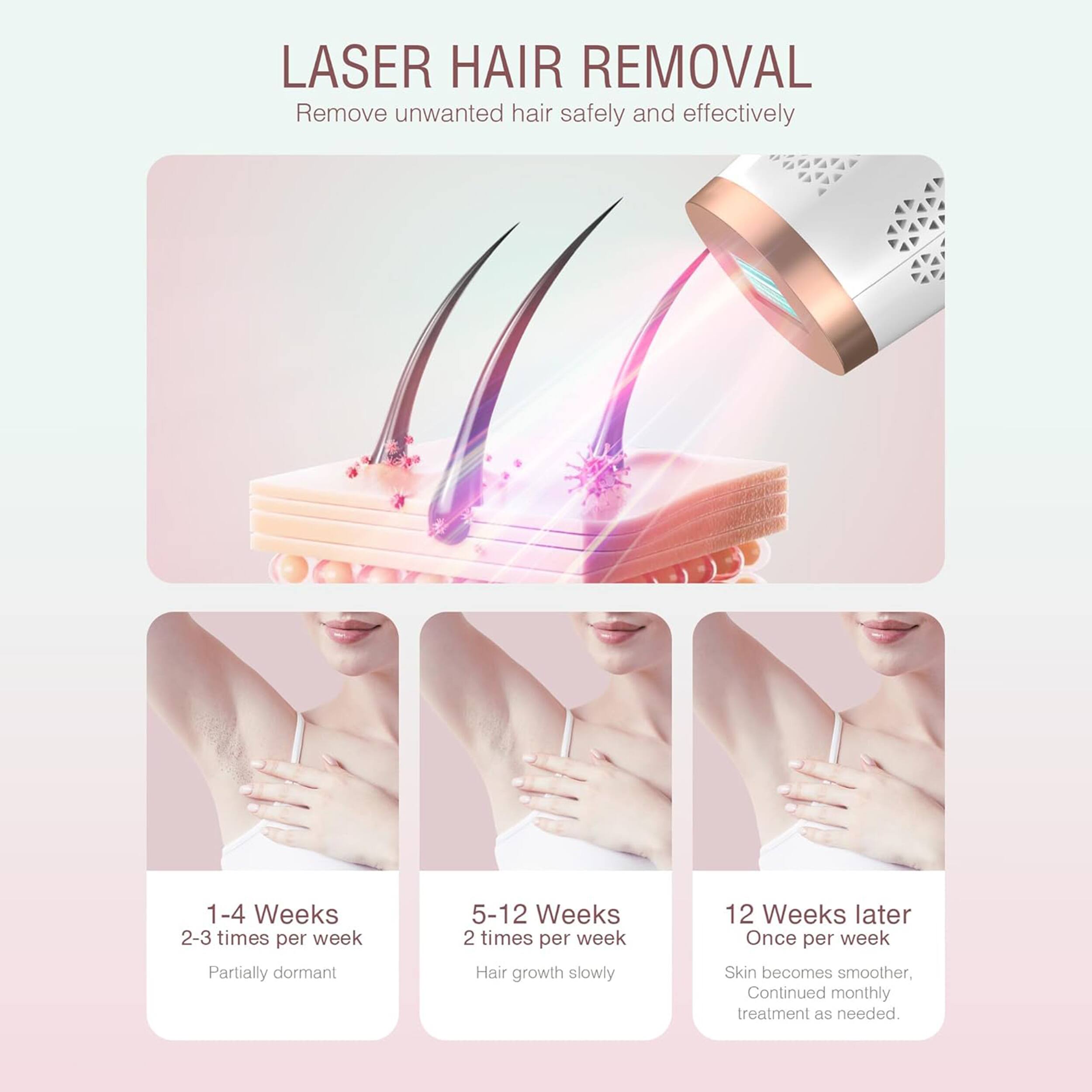 LASER HAIR REMOVAL  
Remove unwanted hair safely and effectively  

1-4 Weeks  
2-3 times per week  
Partially dormant  

5-12 Weeks  
2 times per week  
Hair growth slowly  

12 Weeks later  
Once per week  
Skin becomes smoother,  
Continued monthly treatment as needed.
