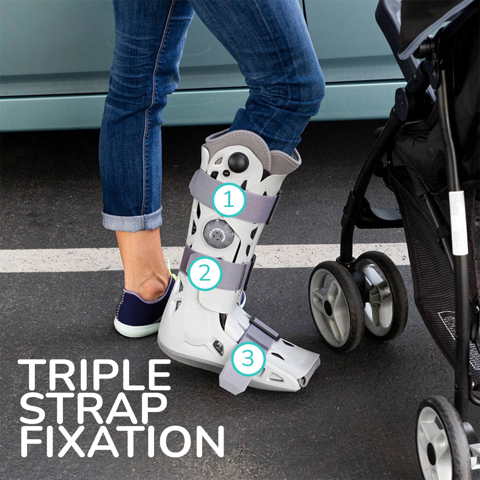 1 2 3 TRIPLE STRAP FIXATION