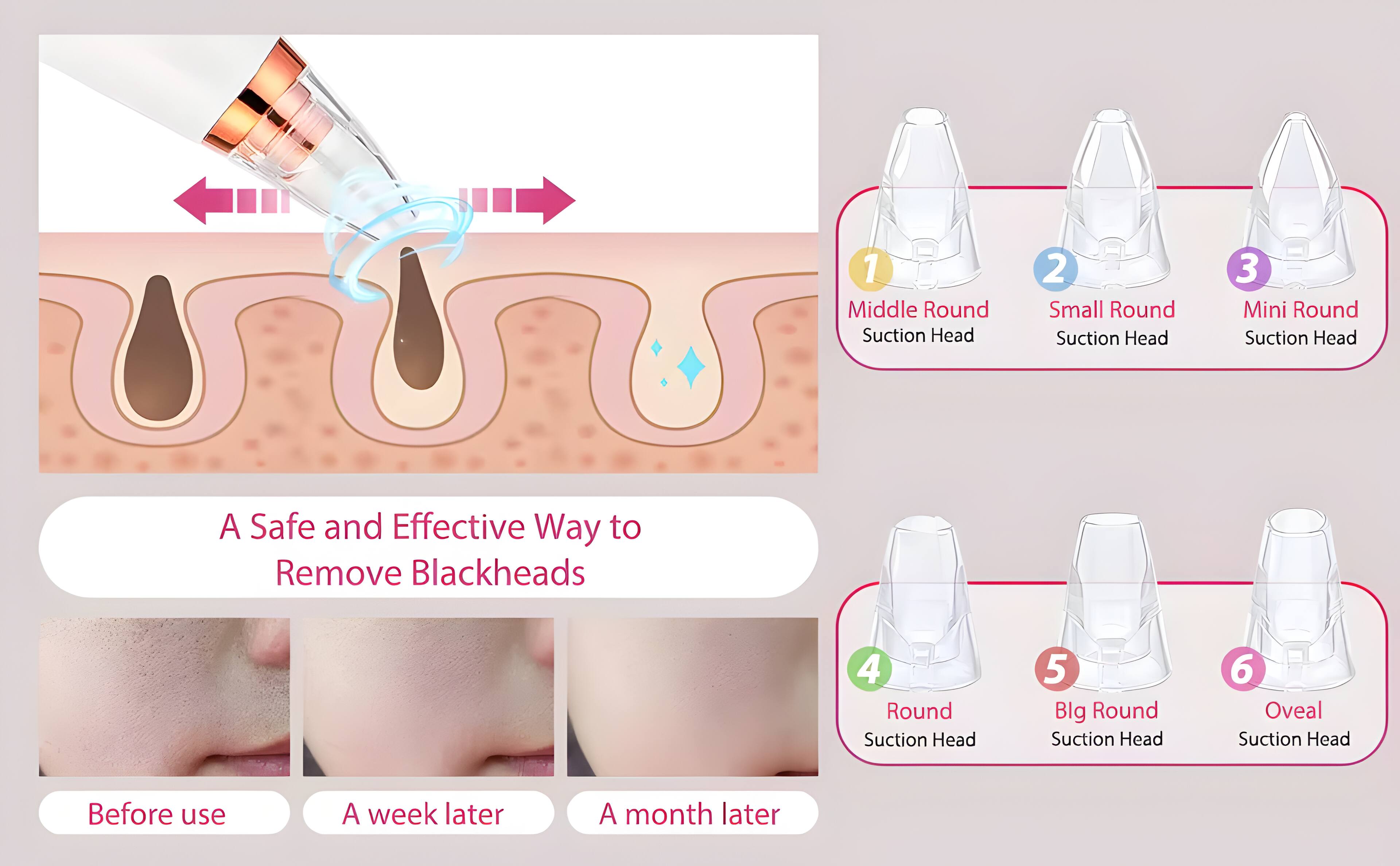 1. Middle Round Suction Head
2. Small Round Suction Head
3. Mini Round Suction Head
4. Round Suction Head
5. Big Round Suction Head
6. Oval Suction Head

A Safe and Effective Way to Remove Blackheads

Before use
A week later
A month later