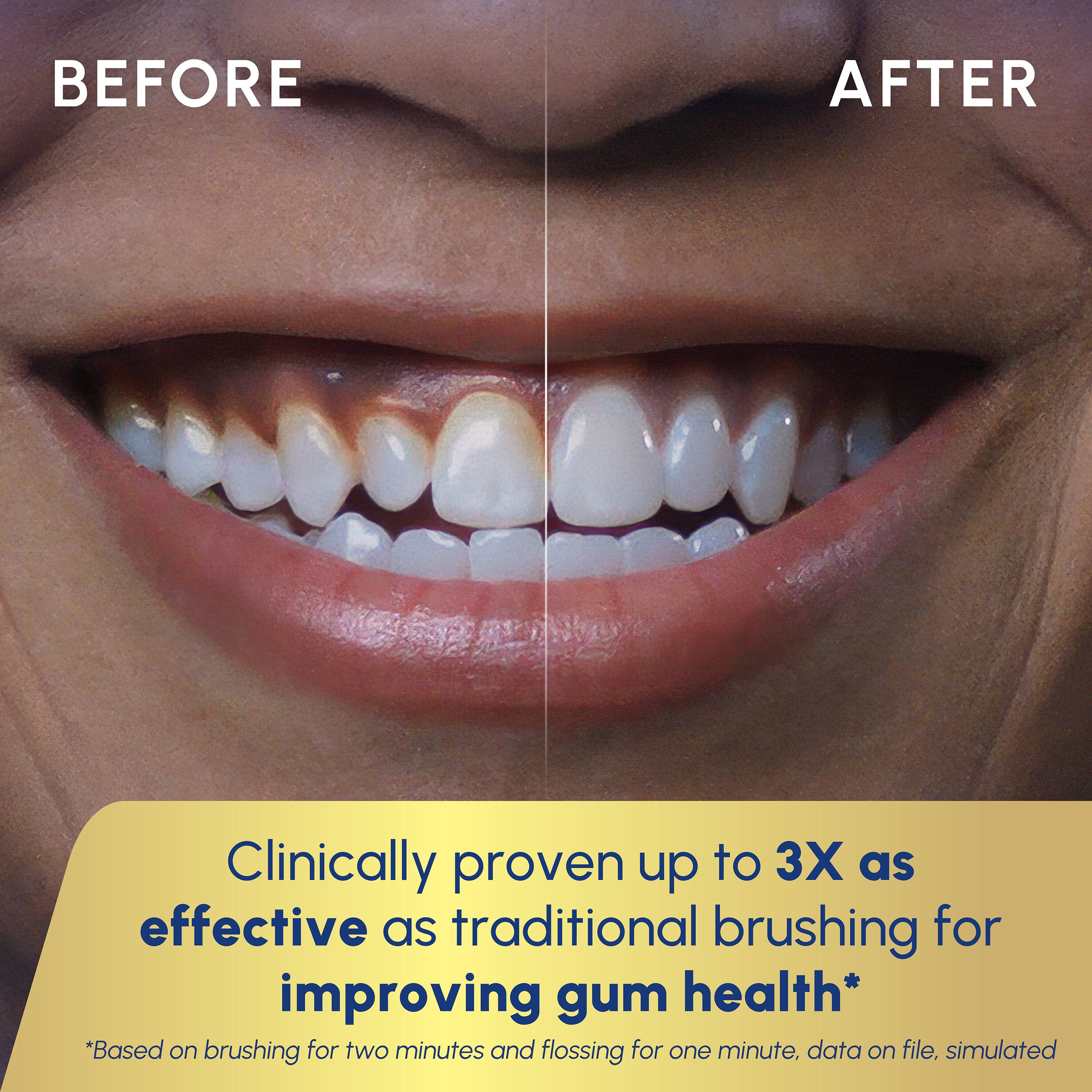 BEFORE AFTER

Clinically proven up to 3X as effective as traditional brushing for improving gum health*

*Based on brushing for two minutes and flossing for one minute, data on file, simulated