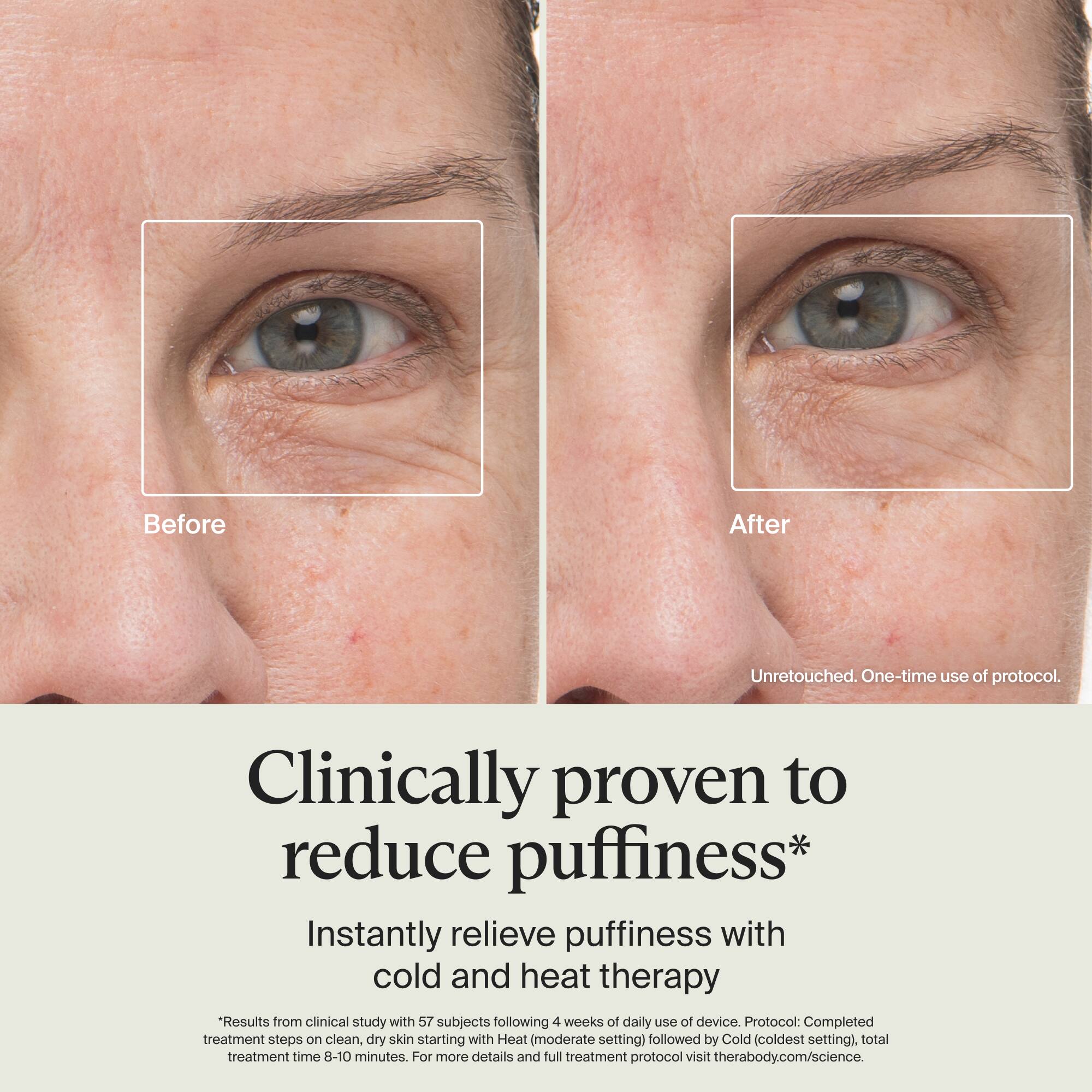 Before  
After  
Unretouched. One-time use of protocol.  

Clinically proven to reduce puffiness*  
Instantly relieve puffiness with cold and heat therapy  

*Results from clinical study with 57 subjects following 4 weeks of daily use of device. Protocol: Completed treatment steps on clean, dry skin starting with Heat (moderate setting) followed by Cold (coldest setting), total treatment time 8-10 minutes. For more details and full treatment protocol visit therabody.com/science.