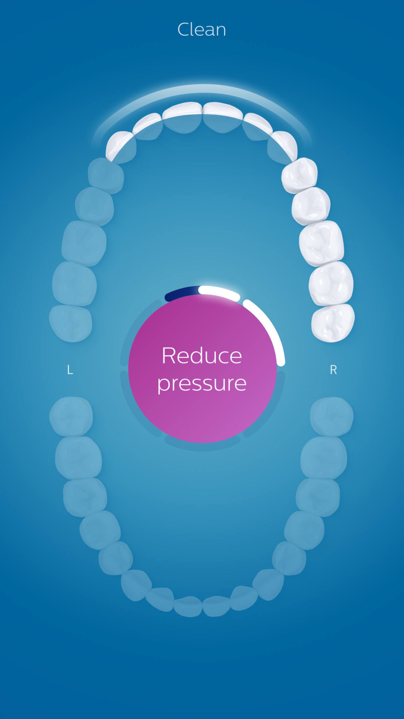 Clean  
Reduce pressure  
L  
R