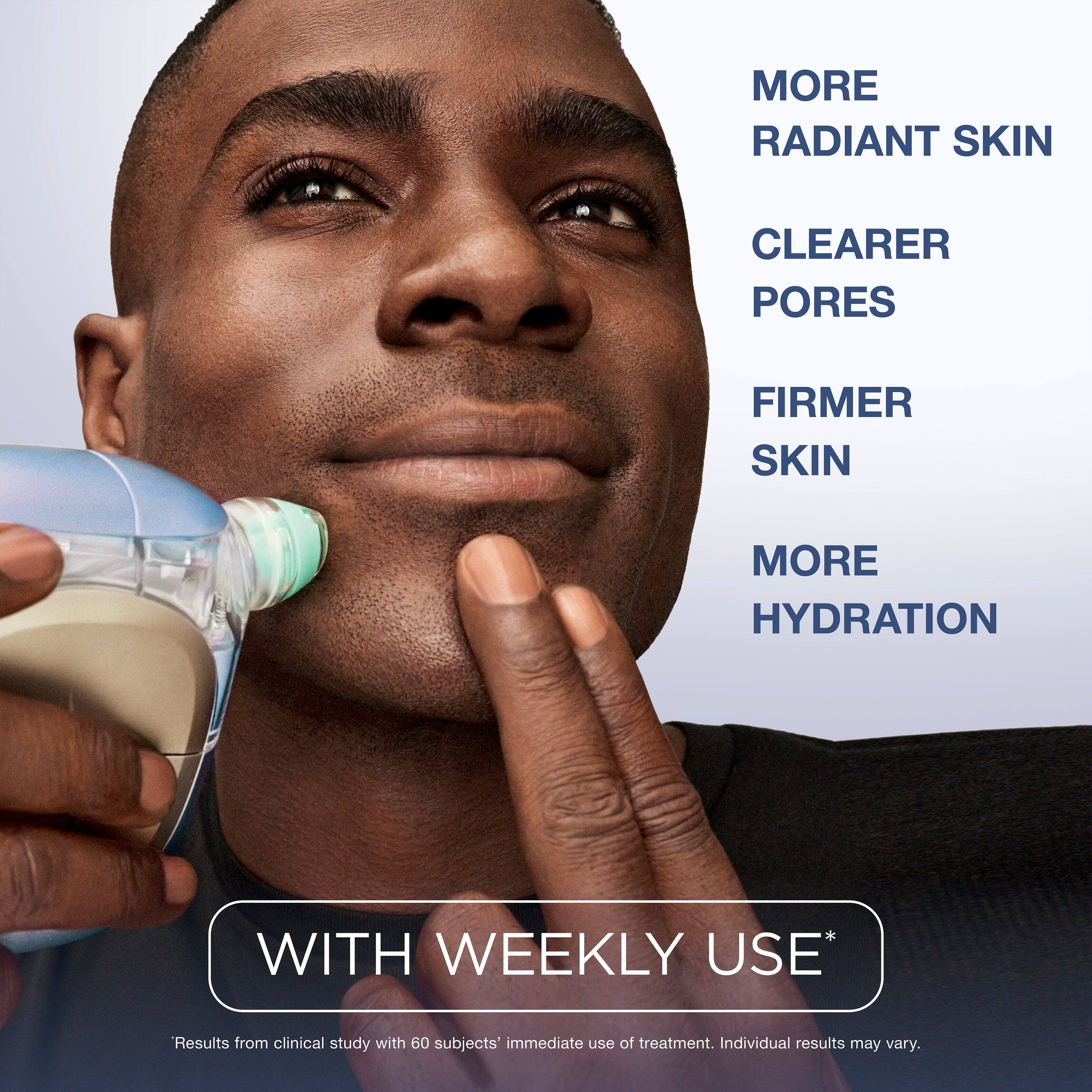 MORE RADIANT SKIN  
CLEARER PORES  
FIRMER SKIN  
MORE HYDRATION  
WITH WEEKLY USE*  
*Results from clinical study with 60 subjects' immediate use of treatment. Individual results may vary.