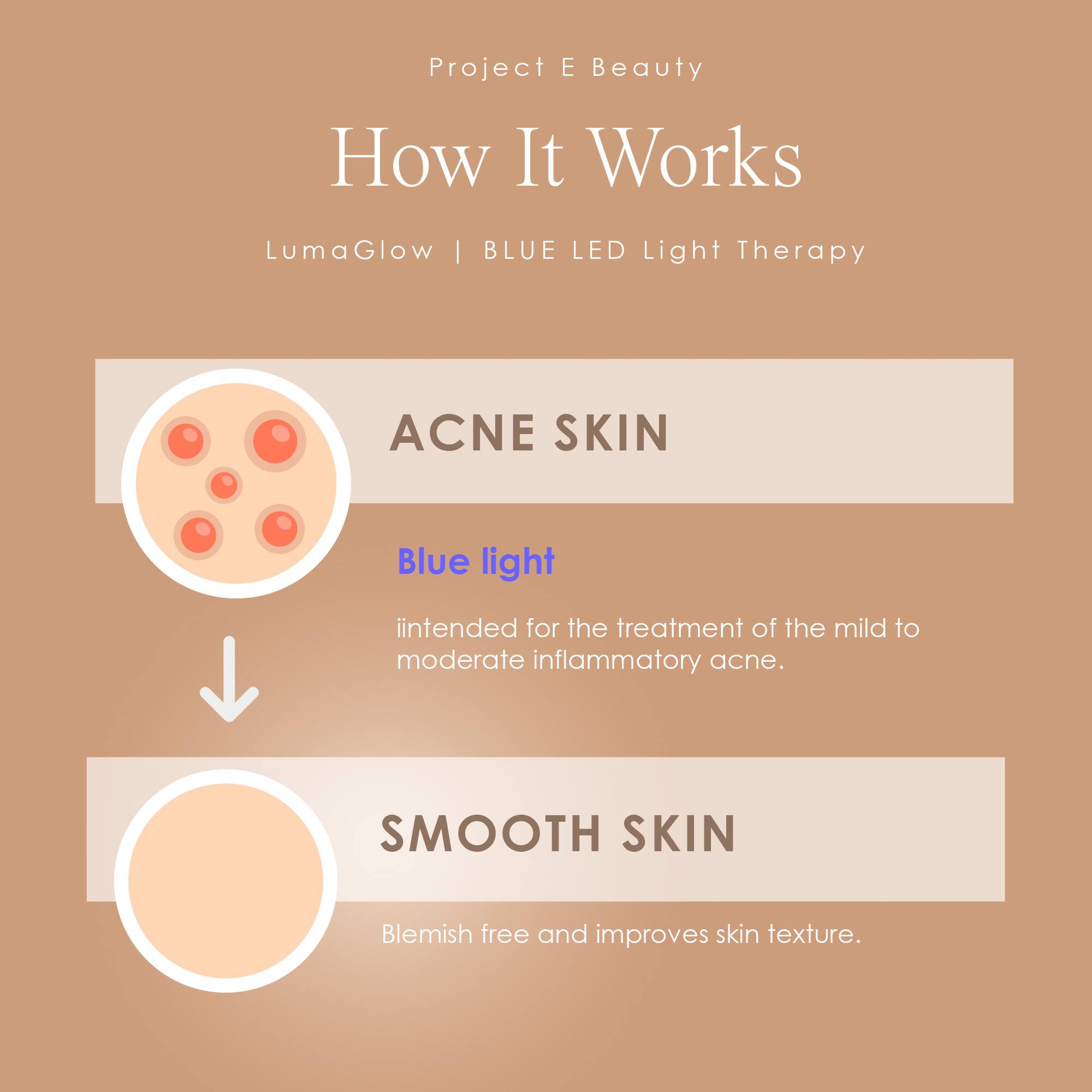 Project E Beauty  
How It Works  
LumaGlow | BLUE LED Light Therapy  

ACNE SKIN  
Blue light  
intended for the treatment of the mild to moderate inflammatory acne.  

SMOOTH SKIN  
Blemish free and improves skin texture.