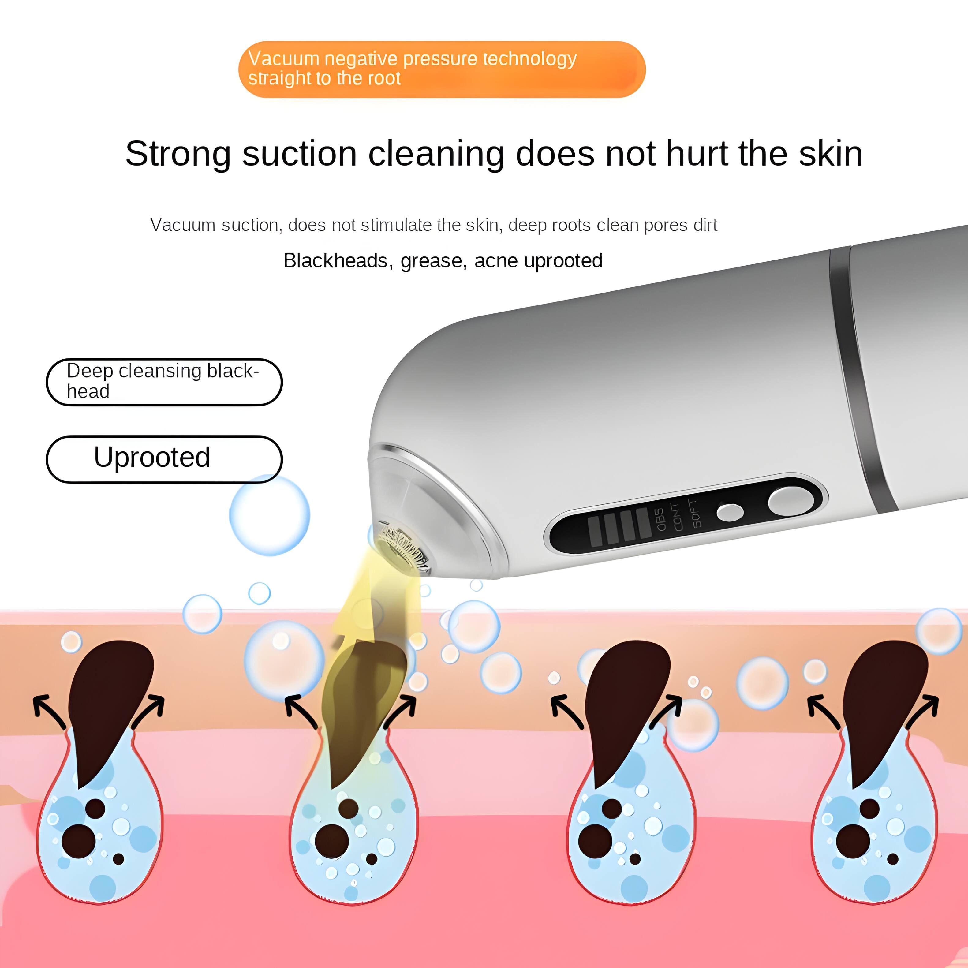 Vacuum negative pressure technology straight to the root

Strong suction cleaning does not hurt the skin

Vacuum suction, does not stimulate the skin, deep roots clean pores dirt

Blackheads, grease, acne uprooted

Deep cleansing black-head

Uprooted
