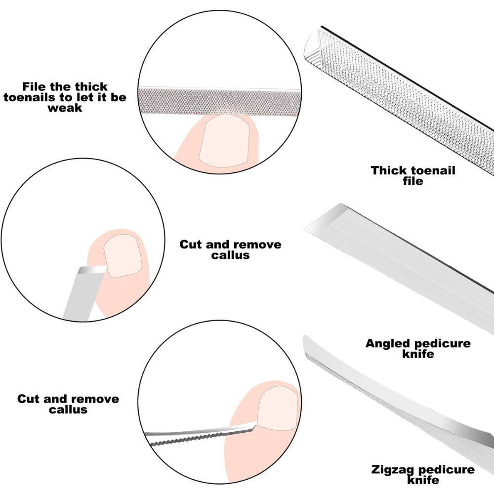 - File the thick toenails to let it be weak
  - Thick toenail file

- Cut and remove callus
  - Angled pedicure knife

- Cut and remove callus
  - Zigzag pedicure knife