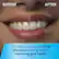 BEFORE AFTER
Clinically proven up to 2X as effective as string floss for improving gum health*
*data on file