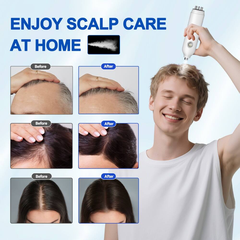ENJOY SCALP CARE AT HOME

Before After

Before After

Before After