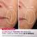 Before unretouched
After 8 weeks unretouched
Better Aging Treatment
CLINICALLY TESTED TO REDUCE FINE LINES & FIRM SKIN IN 8 WEEKS
*Results from 12-week clinical study with 60 subjects and 1x/day use in Better Aging treatment mode. Individual results may vary.