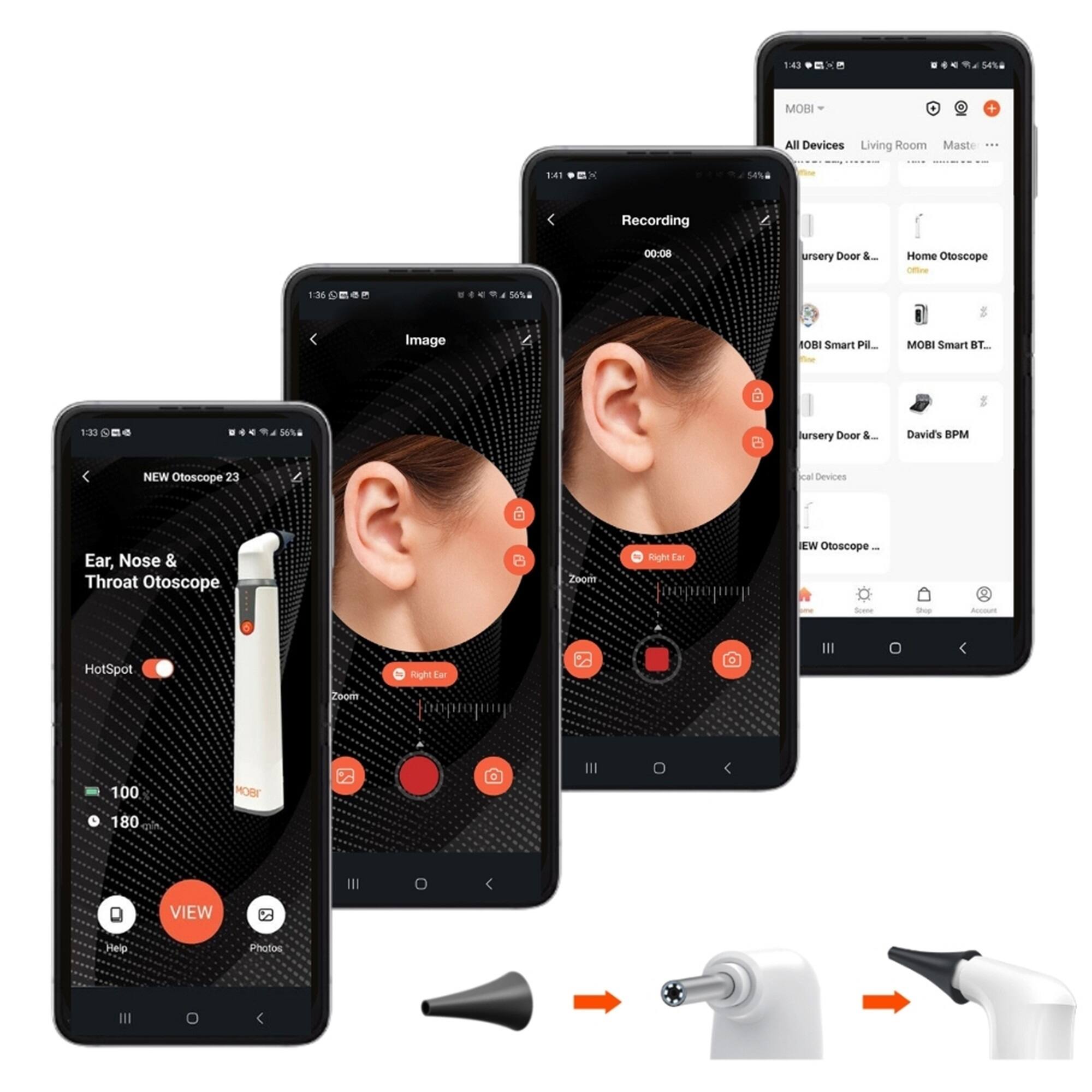 Left. MOBI - Smart Wi-Fi Otoscope 1080P HD Camera With Earwax Removal Tool - White.