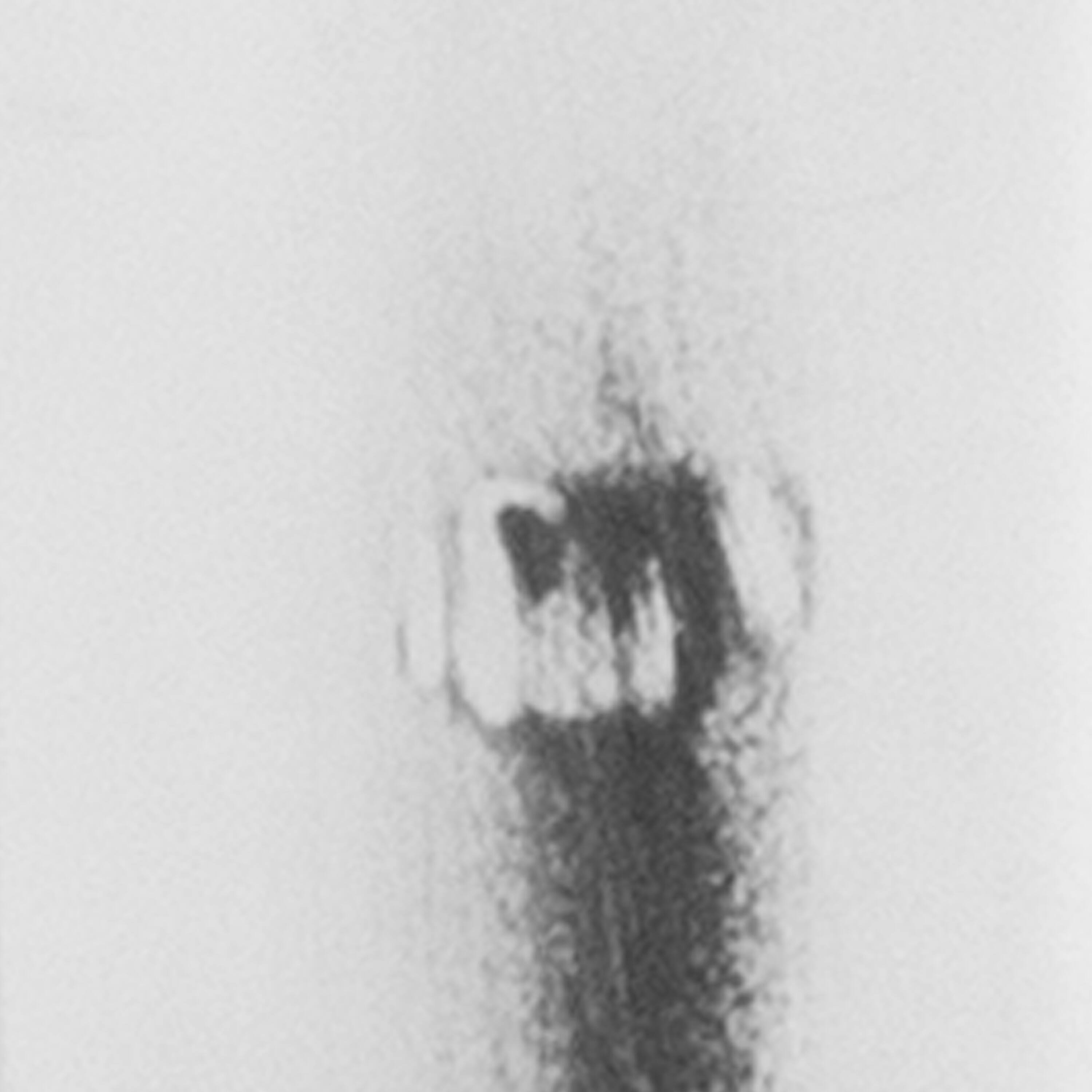 Alt View 9. Emma + Oliver - Commercial Grade 4 Pack 30" High Backless Distressed Metal Indoor-Outdoor Barstool - White.