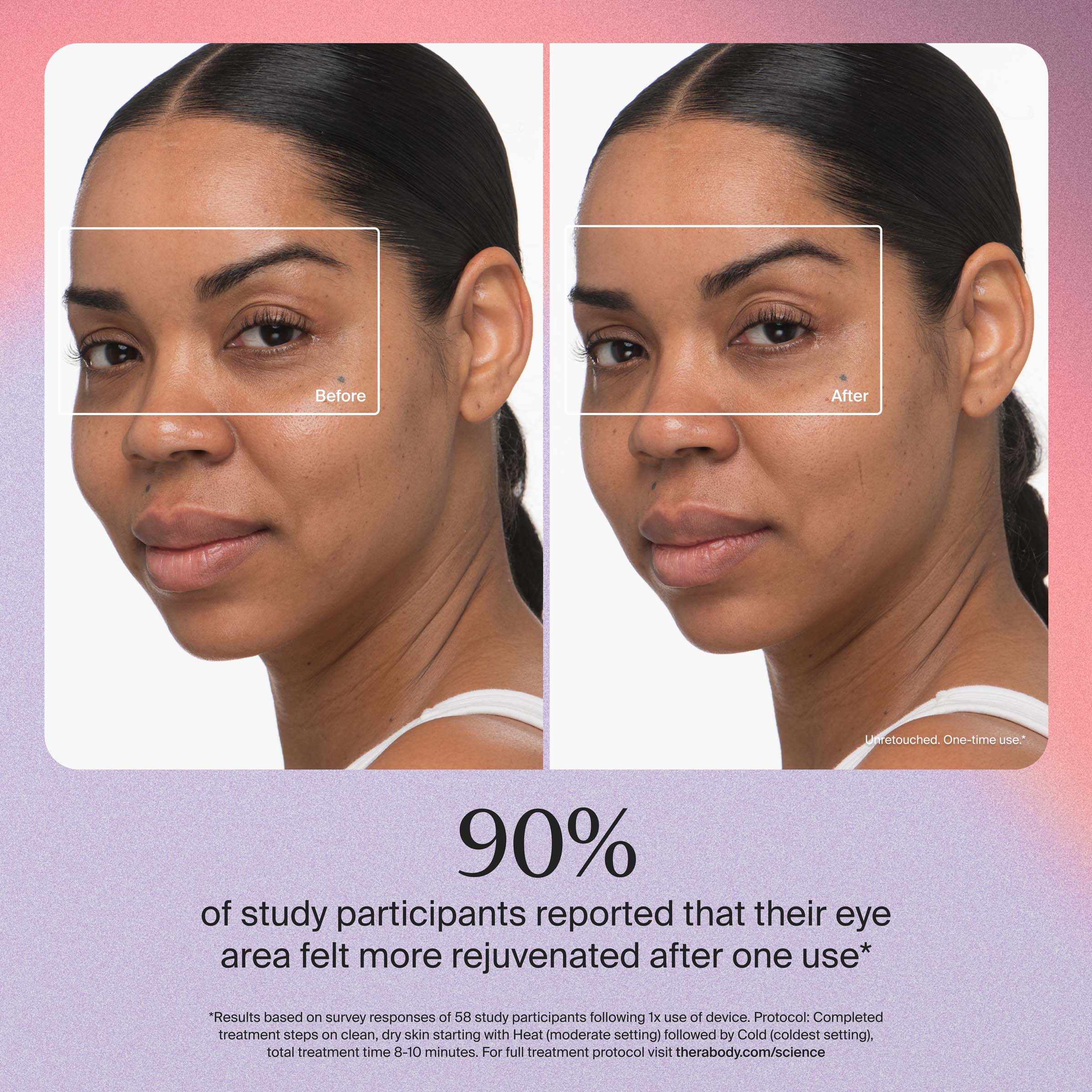 Before After unretouched One-time use.

90% of study participants reported that their eye area felt more rejuvenated after one use*

*Results based on survey responses of 58 study participants following 1x use of device. Protocol: Completed treatment steps on clean, dry skin starting with Heat (moderate setting) followed by Cold (coldest setting). total treatment time 8-10 minutes. For full treatment protocol visit therabody.com/science