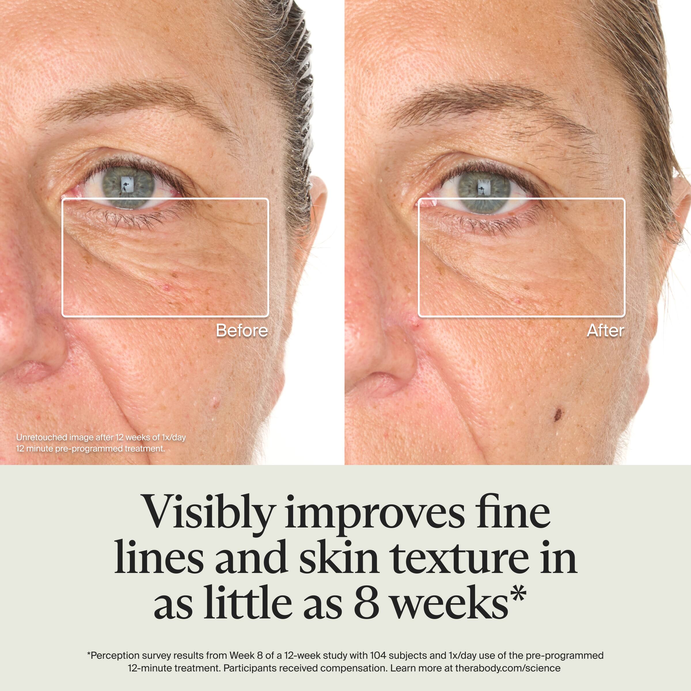 Before After  
Unretouched image after 12 weeks of 1x/day 12-minute pre-programmed treatment.

Visibly improves fine lines and skin texture in as little as 8 weeks*

*Perception survey results from Week 8 of a 12-week study with 104 subjects and 1x/day use of the pre-programmed 12-minute treatment. Participants received compensation. Learn more at therabody.com/science