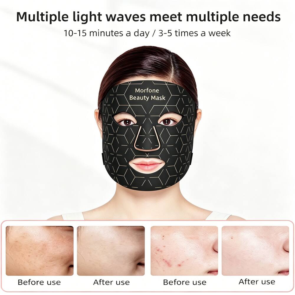 Multiple light waves meet multiple needs  
10-15 minutes a day / 3-5 times a week  

Morfone Beauty Mask  

Before use  
After use  
Before use  
After use