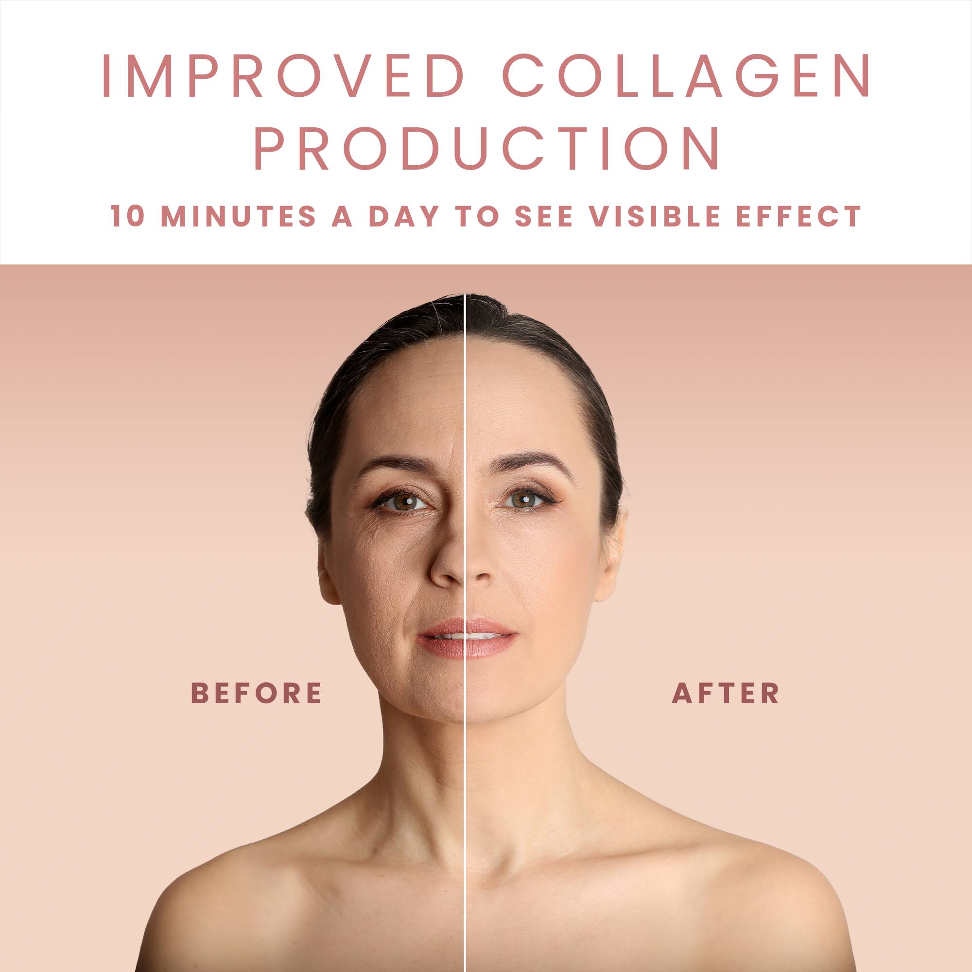 IMPROVED COLLAGEN PRODUCTION  
10 MINUTES A DAY TO SEE VISIBLE EFFECT  

BEFORE  
AFTER
