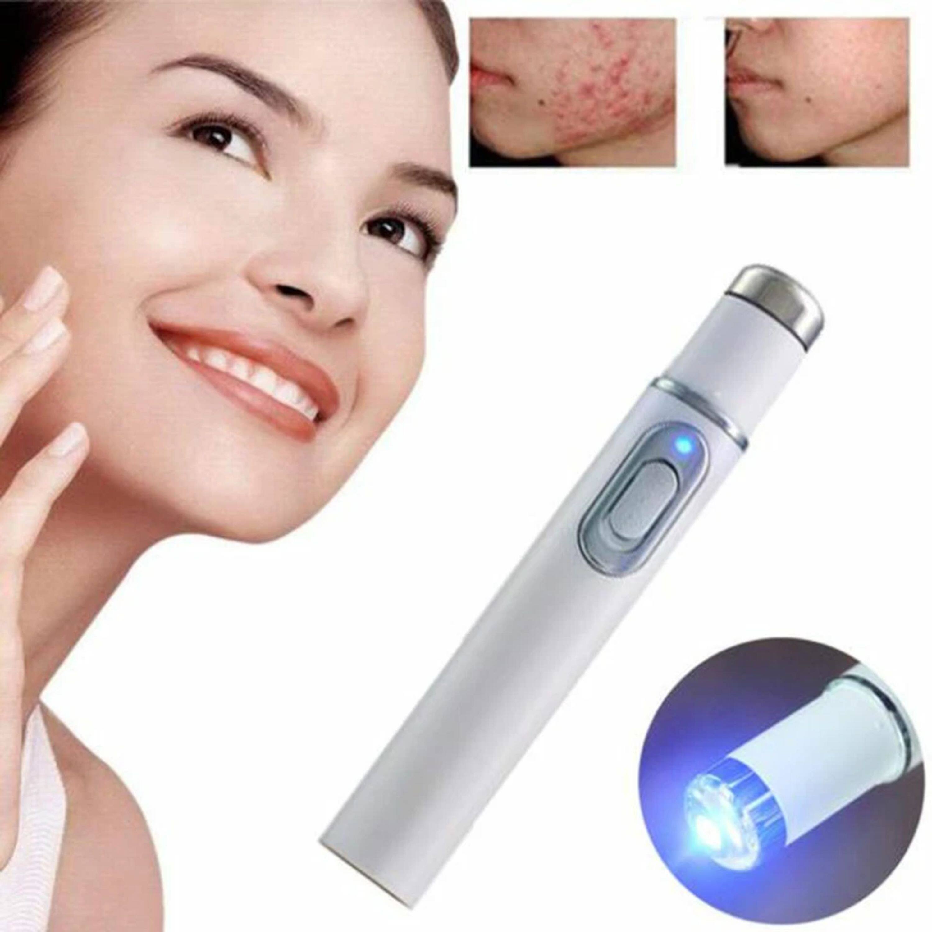 Back. Kitcheniva - Eraser Blue Light Therapy Wrinkle Acne Laser Pen Removal.