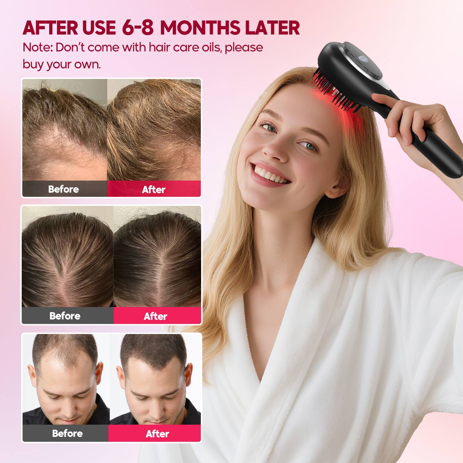 AFTER USE 6-8 MONTHS LATER

Note: Don't come with hair care oils, please buy your own.

Before After

Before After

Before After