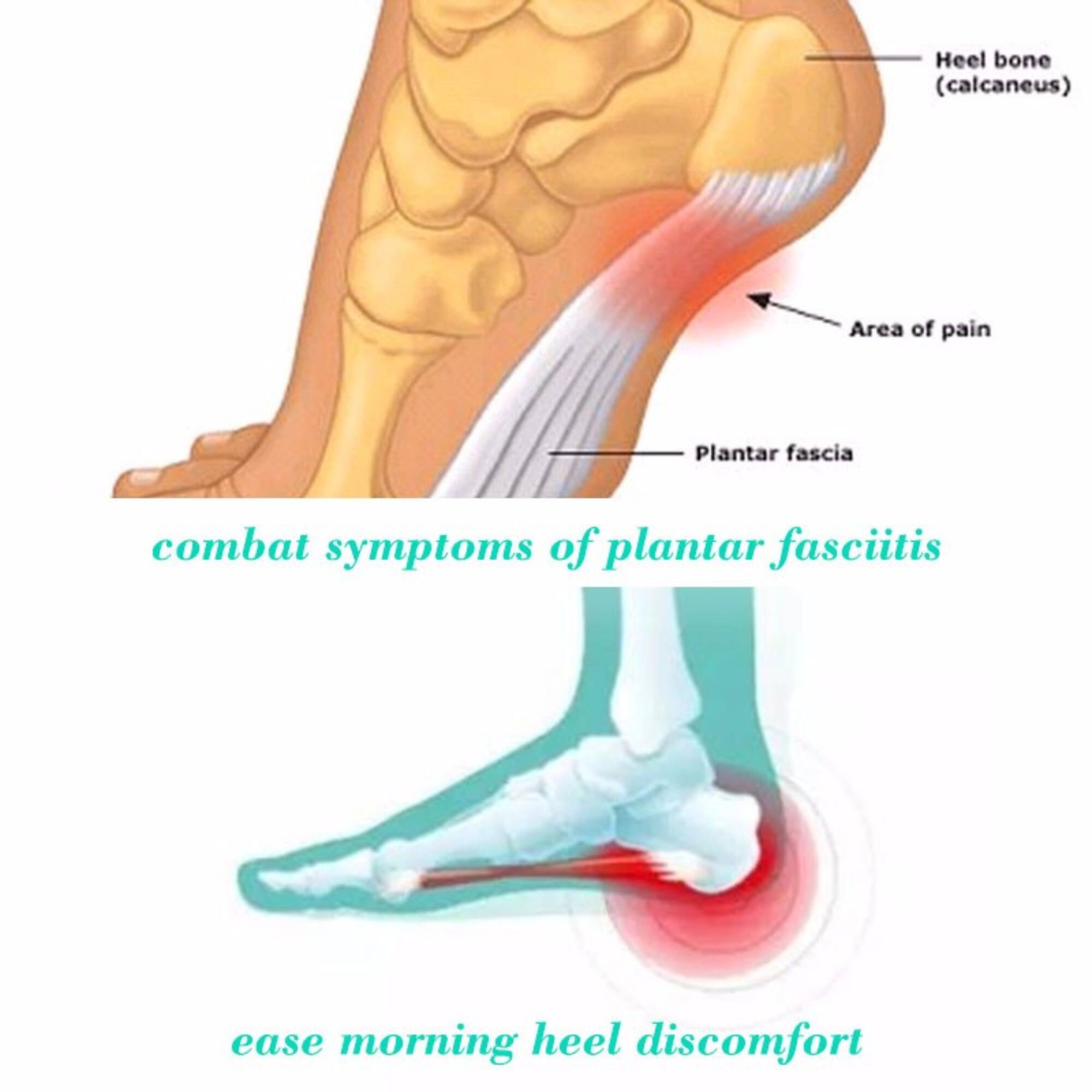 Heel bone (calcaneus)  
Area of pain  
Plantar fascia  

combat symptoms of plantar fasciitis  

ease morning heel discomfort