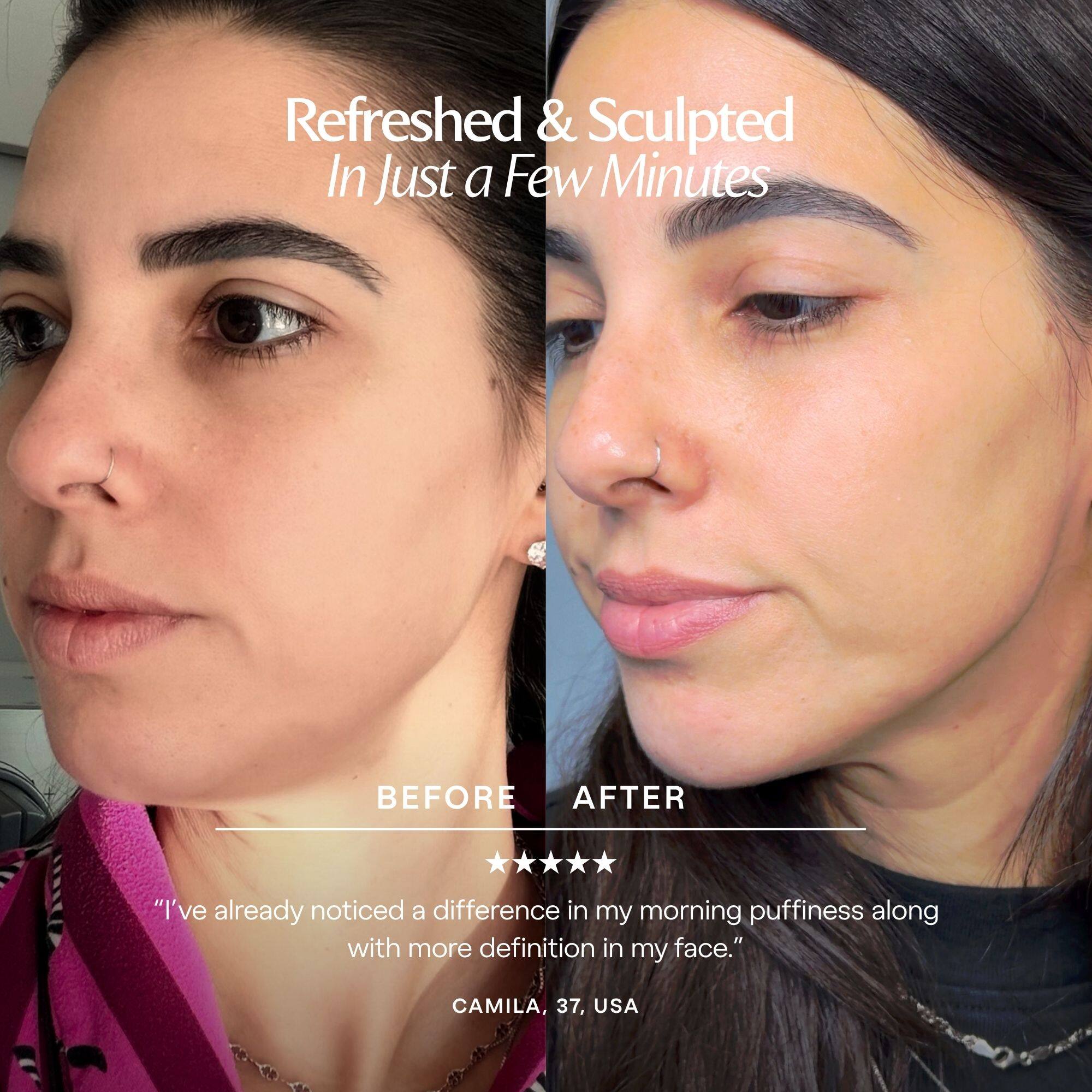 Refreshed & Sculpted In Just a Few Minutes

BEFORE AFTER

"I've already noticed a difference in my morning puffiness along with more definition in my face."

CAMILA, 37, USA