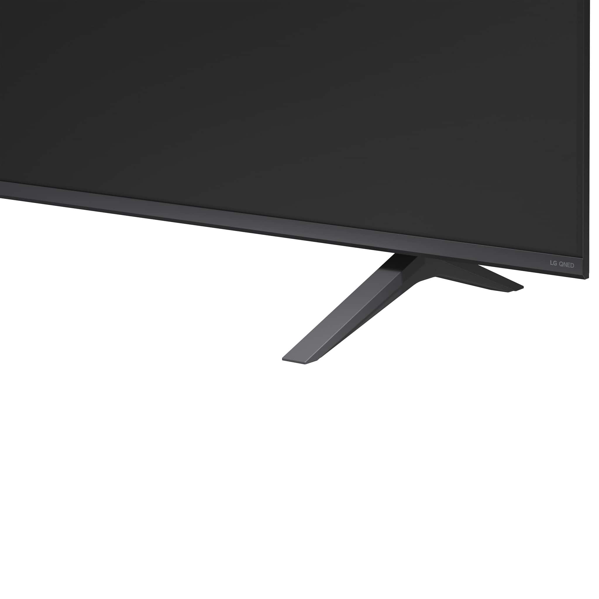 LG 75