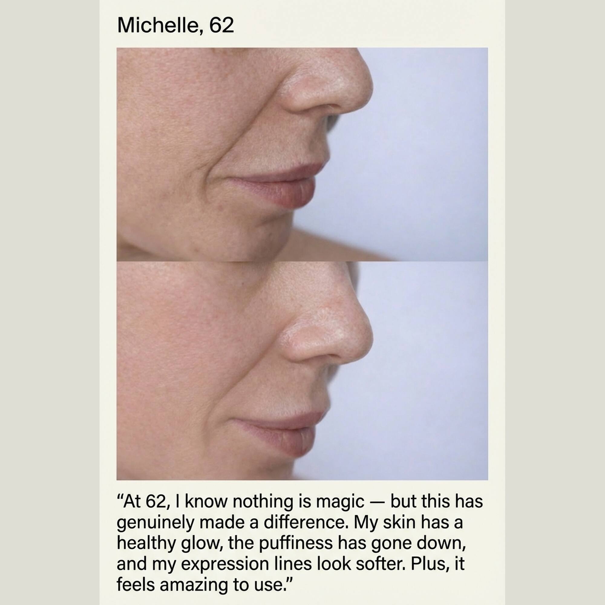 Michelle, 62

"At 62, I know nothing is magic — but this has genuinely made a difference. My skin has a healthy glow, the puffiness has gone down, and my expression lines look softer. Plus, it feels amazing to use."