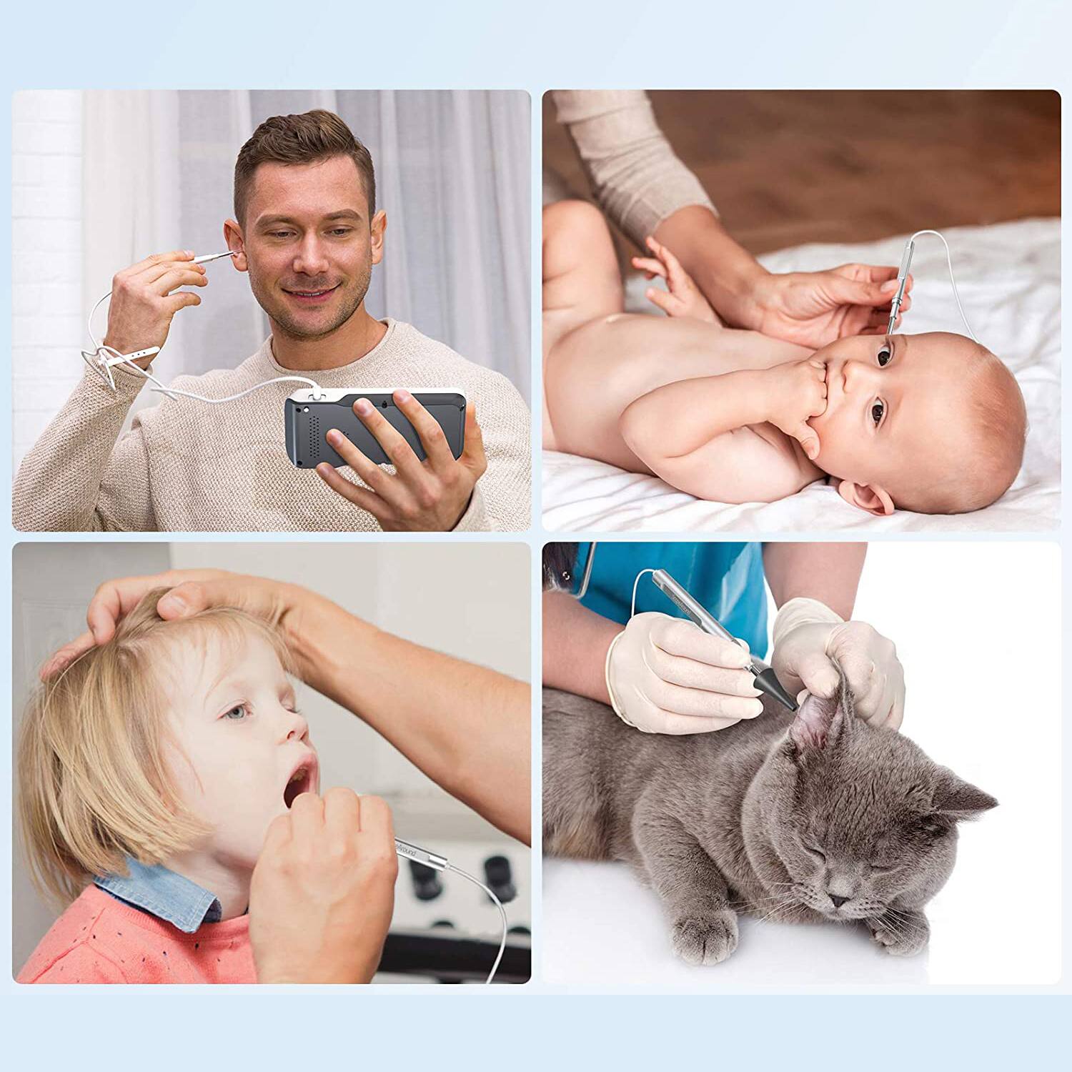 Alt View 6. Scopearound - MS450 Digital  Otoscope with 5"  Screen  Ear Wax Removal Kit - White / Grey / Blue Lime Green.