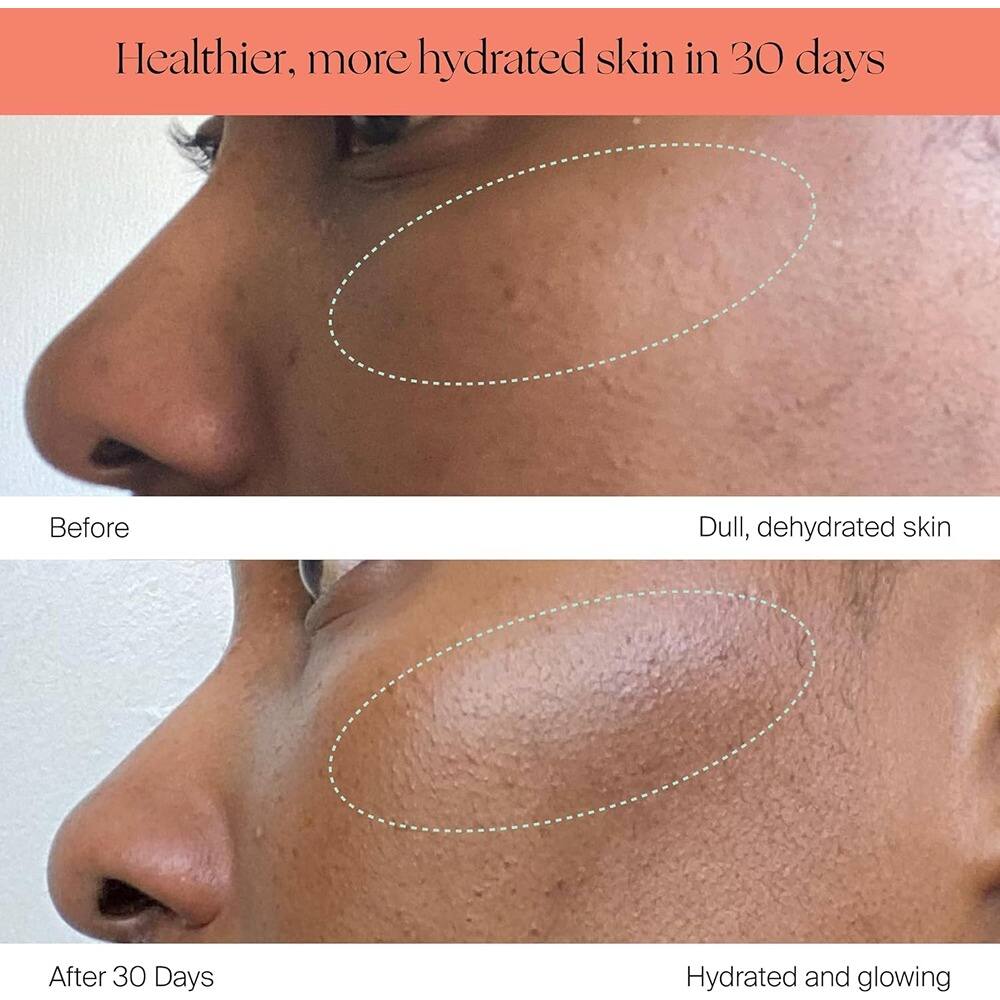 Healthier, more hydrated skin in 30 days

Before  
Dull, dehydrated skin

After 30 Days  
Hydrated and glowing