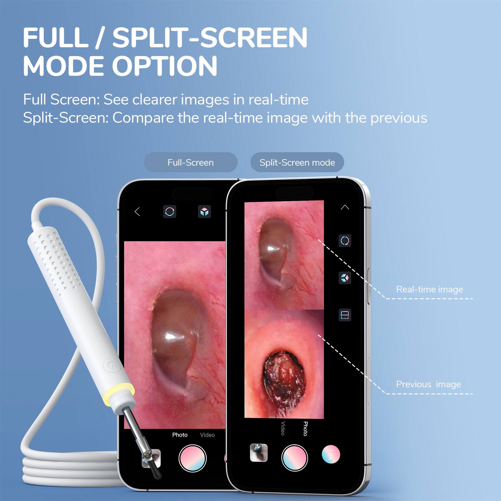 FULL / SPLIT-SCREEN MODE OPTION

Full Screen: See clearer images in real-time

Split-Screen: Compare the real-time image with the previous

Full-Screen

Split-Screen mode

Real-time image

Previous image

Photo Video

Video Photo