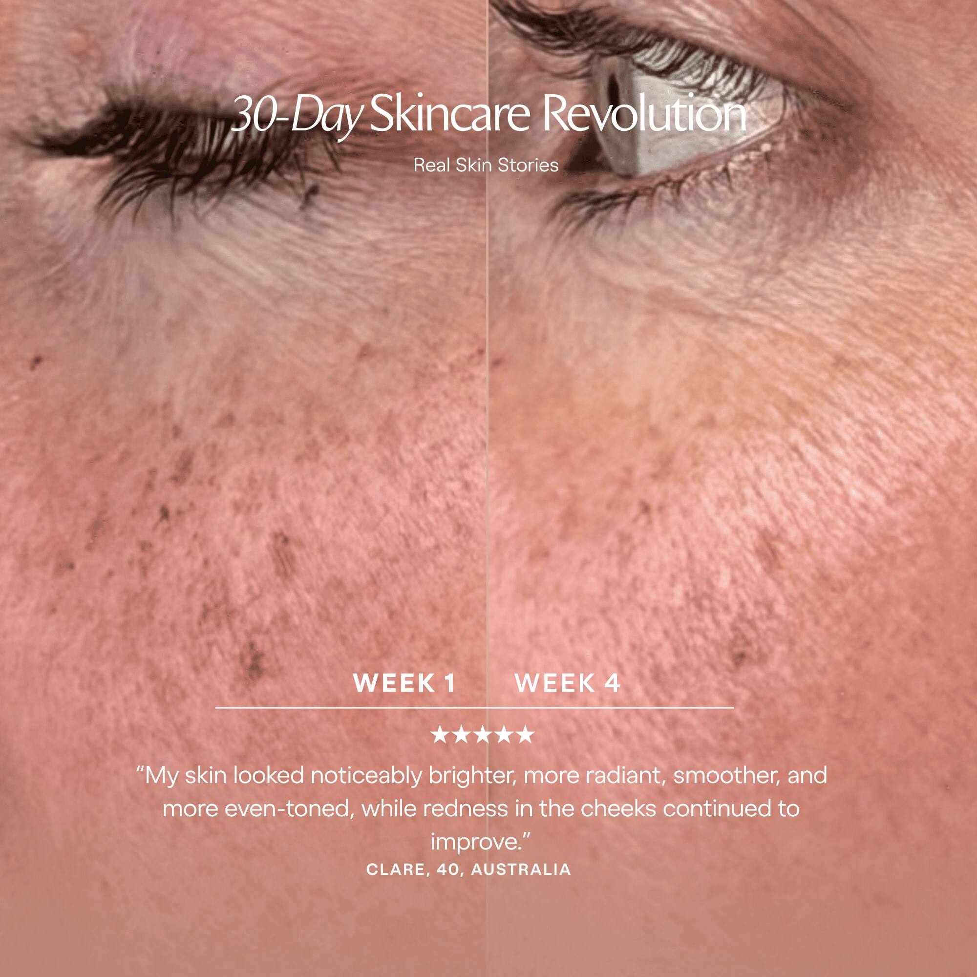 30-Day Skincare Revolution  
Real Skin Stories

WEEK 1  
WEEK 4

"My skin looked noticeably brighter, more radiant, smoother, and more even-toned, while redness in the cheeks continued to improve."  
CLARE, 40, AUSTRALIA