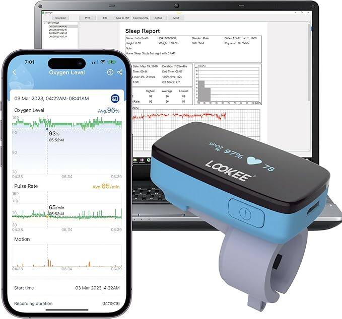 **Sleep Report**
- **Name:** John Smith
- **DOB:** 06/06/1957
- **Gender:** Male
- **Date of Birth:** Jan 1, 1950
- **Physician:** Dr. White
- **Height:** 6.0 ft
- **Weight:** 100 lbs
- **BMI:** 24.4
- **Home Sleep Study first night with CPAP**
- **Date:** May 18, 2019
- **Time:** 00:44
- **End Time:** 08:07
- **Duration:** 4h 22m
- **Oxygen Level:**
- **Highest:** 99%
- **Average:** 96%
- **Lowest:** 89%
- **Time:** 302%
- **2 times over 90%**
- **Pulse Rate:**
- **Highest:** 93
- **Average:** 66
- **Lowest:** 51
- **Motion:**
- **Highest:** 90
-