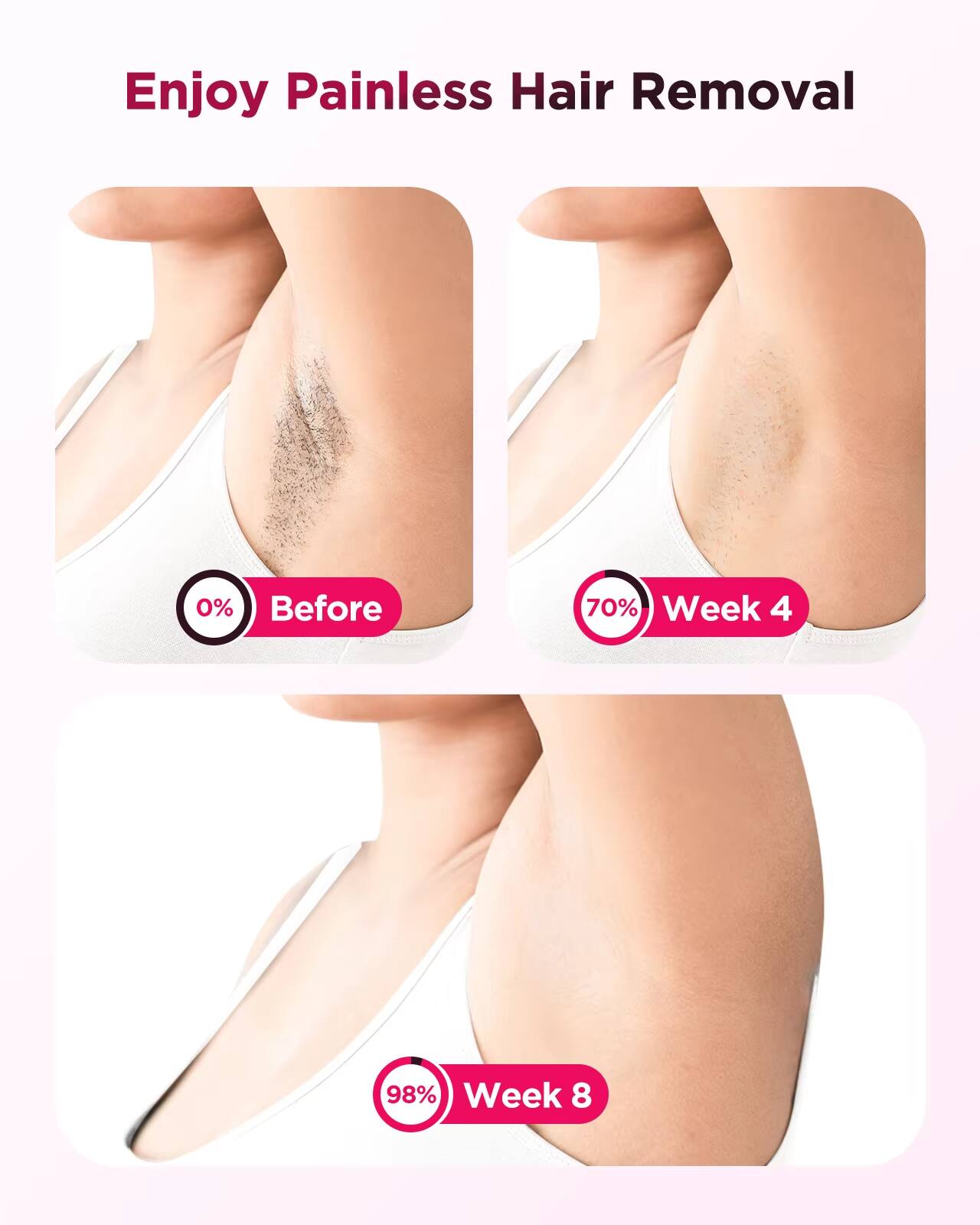 Enjoy Painless Hair Removal

0% Before

70% Week 4

98% Week 8
