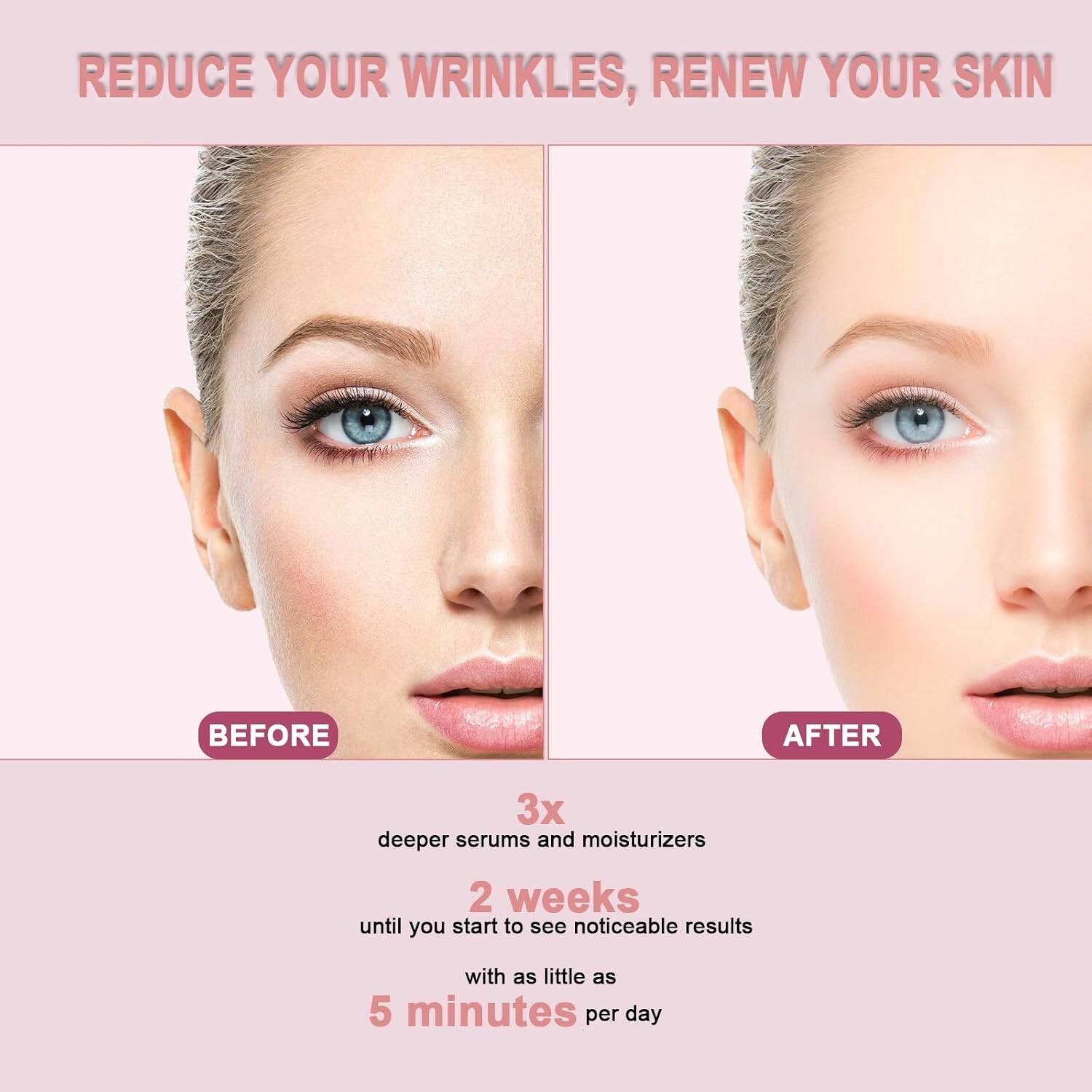 REDUCE YOUR WRINKLES, RENEW YOUR SKIN

BEFORE

AFTER

3x deeper serums and moisturizers

2 weeks until you start to see noticeable results with as little as 5 minutes per day