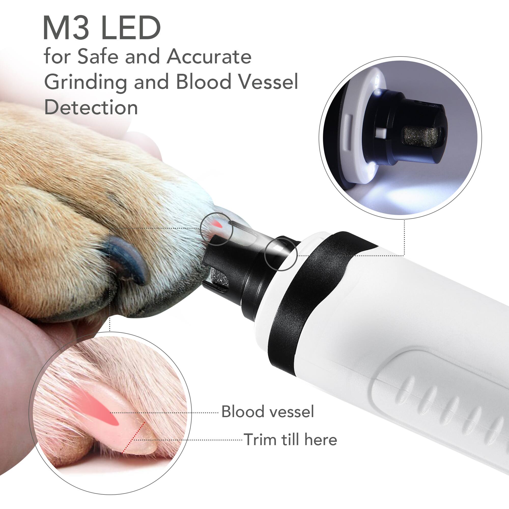 M3 LED  
for Safe and Accurate Grinding and Blood Vessel Detection  

Blood vessel  
Trim till here