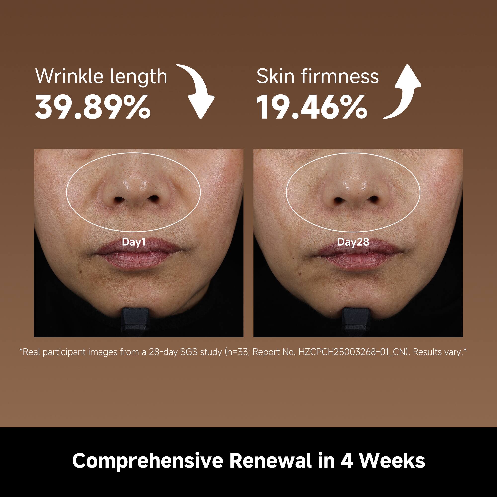 Wrinkle length 39.89%  
Skin firmness 19.46%  
Day1 Day28  

*Real participant images from a 28-day SGS study (n=33: Report No. HZCPCH25003268-01_CN). Results vary.*  

Comprehensive Renewal in 4 Weeks