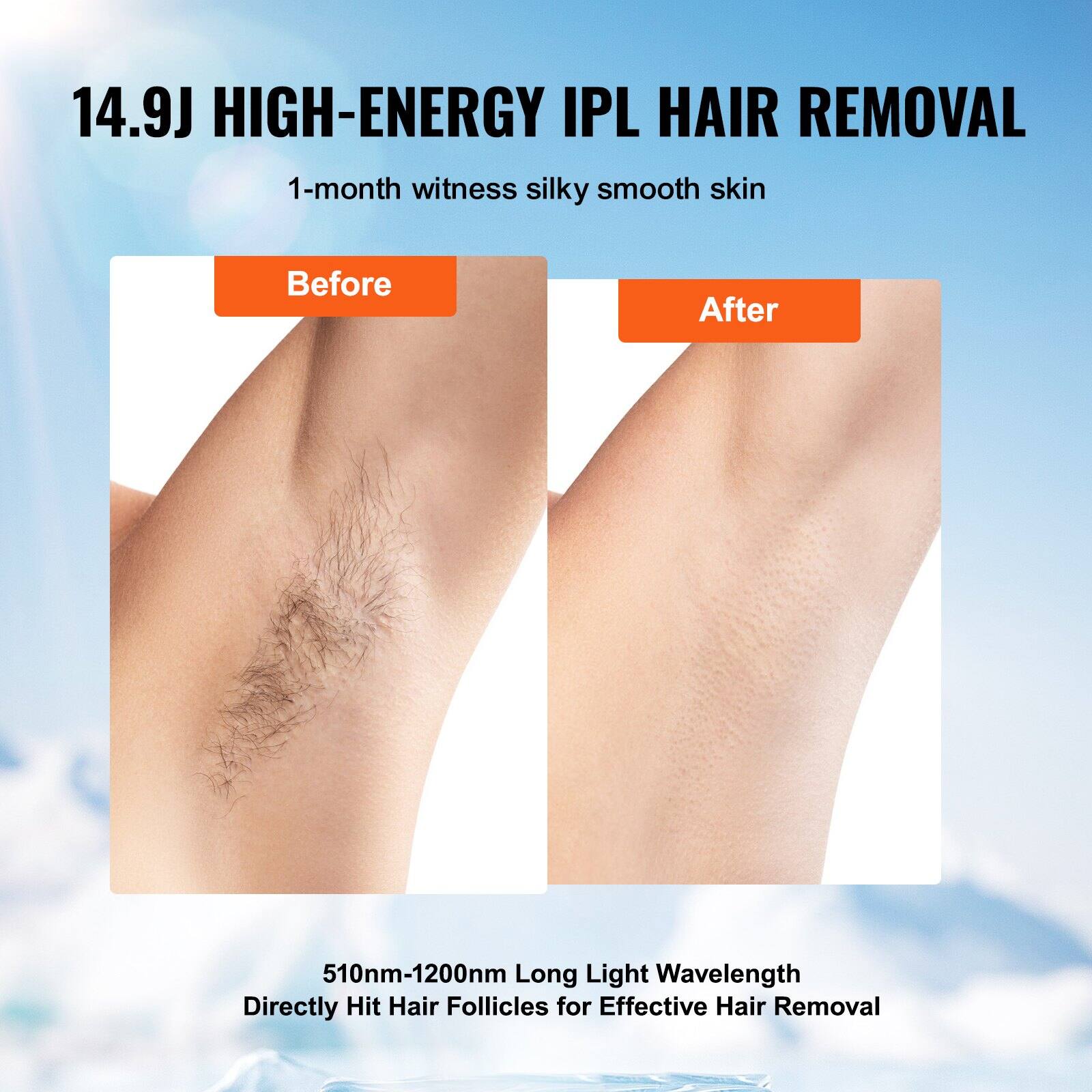 14.9J HIGH-ENERGY IPL HAIR REMOVAL

1-month witness silky smooth skin

Before After

510nm-1200nm Long Light Wavelength Directly Hit Hair Follicles for Effective Hair Removal