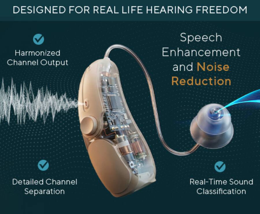 DESIGNED FOR REAL LIFE HEARING FREEDOM

- Harmonized Channel Output
- Detailed Channel Separation
- Speech Enhancement and Noise Reduction
- Real-Time Sound Classification